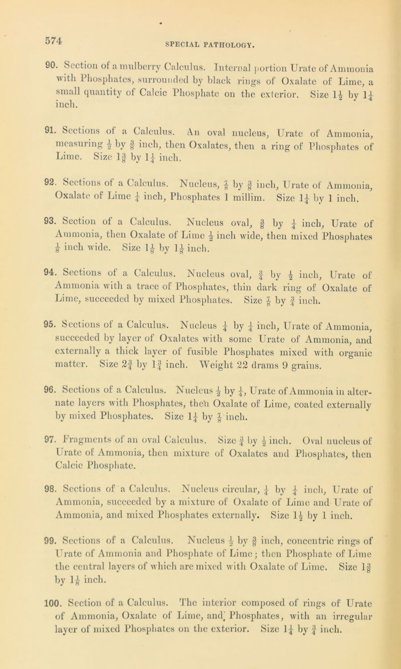 SPECIAL PATHOLOGY. 90. Section of a mulberry Calculus. Internal portion Urate of Ammonia with Phosphates, surrounded by black rings of Oxalate of Lime, a small quantity of Calcic Phosphate on the exterior. Size If by If inch. 91. Sections of a Calculus. An oval nucleus. Urate of Ammonia, measuring f- by f inch, then Oxalates, then a ring of Phosphates of Lime. Size If by If inch. 92. Sections of a Calculus. Nucleus, f by f inch. Urate of Ammonia, Oxalate of Lime f inch, Phosphates 1 millim. Size If by 1 inch. 93. Section of a Calculus. Nucleus oval, f by f inch, Urate of Ammonia, then Oxalate of Lime f- inch wide, then mixed Phosphates f inch wide. Size If by If inch. 94. Sections of a Calculus. Nucleus oval, f by f inch, Urate of Ammonia with a trace of Phosphates, thin dark ring of Oxalate of Lime, succeeded by mixed Phosphates. Size f by f inch. 95. Sections of a Calculus. Nucleus f by f inch. Urate of Ammonia, succeeded by layer of Oxalates with some Urate of Ammonia, and externally a thick layer of fusible Phosphates mixed with organic matter. Size 2f by If inch. Weight 22 drams 9 grains. 96. Sections of a Calculus. Nucleus f by f, Urate of Ammonia in alter- nate layers with Phosphates, theh Oxalate of Lime, coated externally by mixed Phosphates. Size If by f inch. 97. Fragments of an oval Calculus. Size f by f inch. Oval nucleus of Urate of Ammonia, then mixture of Oxalates and Phosphates, then Calcic Phosphate. 98. Sections of a Calculus. Nucleus circular, f by f inch, Urate of Ammonia, succeeded by a mixture of Oxalate of Lime and Urate of Ammonia, and mixed Phosphates externally. Size If by 1 inch. 99. Sections of a Calculus. Nucleus -f by § inch, concentric rings of Urate of Ammonia and Phosphate of Lime; then Phosphate of Lime the central layers of which are mixed with Oxalate of Lime. Size 1| by If inch. 100. Section of a Calculus. The interior composed of rings of Urate of Ammonia, Oxalate of Lime, and’ Phosphates, with an irregular layer of mixed Phosphates on the exterior. Size If by f inch.