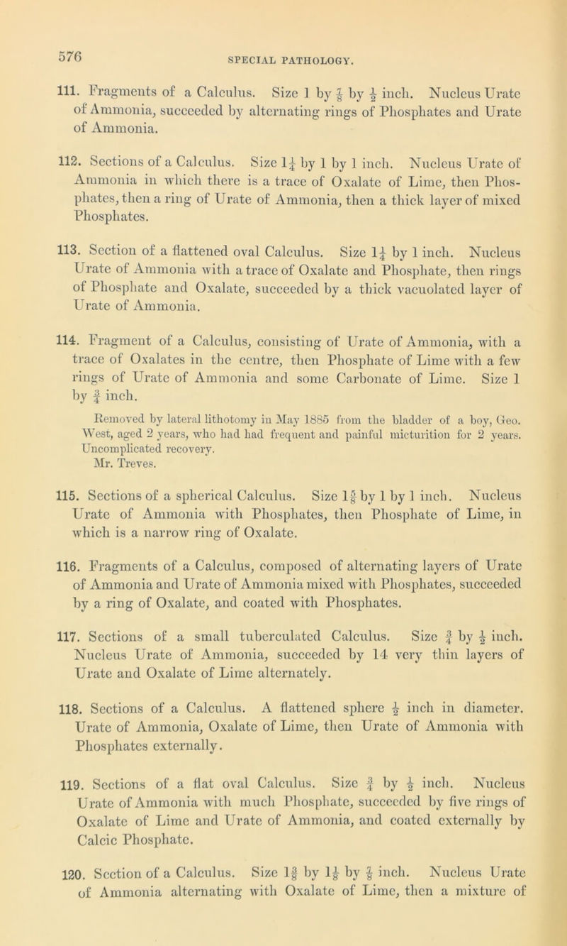 111. Fragments of a Calculus. Size! by f by f inch. Nucleus Urate of Ammonia, succeeded by alternating rings of Phosphates and Urate of Ammonia. 112. Sections ot a Calculus. Size If by 1 by 1 inch. Nucleus Urate of Ammonia in which there is a trace of Oxalate of Lime, then Phos- phates, then a ring of Urate of Ammonia, then a thick layer of mixed Phosphates. 113. Section of a flattened oval Calculus. Size If by 1 inch. Nucleus l rate of Ammonia with a trace of Oxalate and Phosphate, then rings ot Phosphate and Oxalate, succeeded by a thick vacuolated layer of Urate of Ammonia. 114. Fragment of a Calculus, consisting of Urate of Ammonia, with a trace of Oxalates in the centre, then Phosphate of Lime with a few rings of Urate of Ammonia and some Carbonate of Lime. Size 1 by f inch. Removed by lateral lithotomy in May 1885 from the bladder of a boy, Geo. West, aged 2 years, who had had frequent and painful micturition for 2 years. Uncomplicated recovery. Mr. Treves. 115. Sections of a spherical Calculus. Size If by 1 by 1 inch. Nucleus Urate of Ammonia with Phosphates, then Phosphate of Lime, in which is a narrotv ring of Oxalate. 116. Fragments of a Calculus, composed of alternating layers of Urate of Ammonia and Urate of Ammonia mixed with Phosphates, succeeded by a ring of Oxalate, and coated with Phosphates. 117. Sections of a small tuberculated Calculus. Size f by f inch. Nucleus Urate of Ammonia, succeeded by 14 very thin layers of Urate and Oxalate of Lime alternately. 118. Sections of a Calculus. A flattened sphere f inch in diameter. Urate of Ammonia, Oxalate of Lime, then Urate of Ammonia with Phosphates externally. 119. Sections of a flat oval Calculus. Size f by f inch. Nucleus Urate of Ammonia with much Phosphate, succeeded by five rings of Oxalate of Lime and Urate of Ammonia, and coated externally by Calcic Phosphate. 120. Section of a Calculus. Size If by If by f inch. Nucleus Urate of Ammonia alternating with Oxalate of Lime, then a mixture of