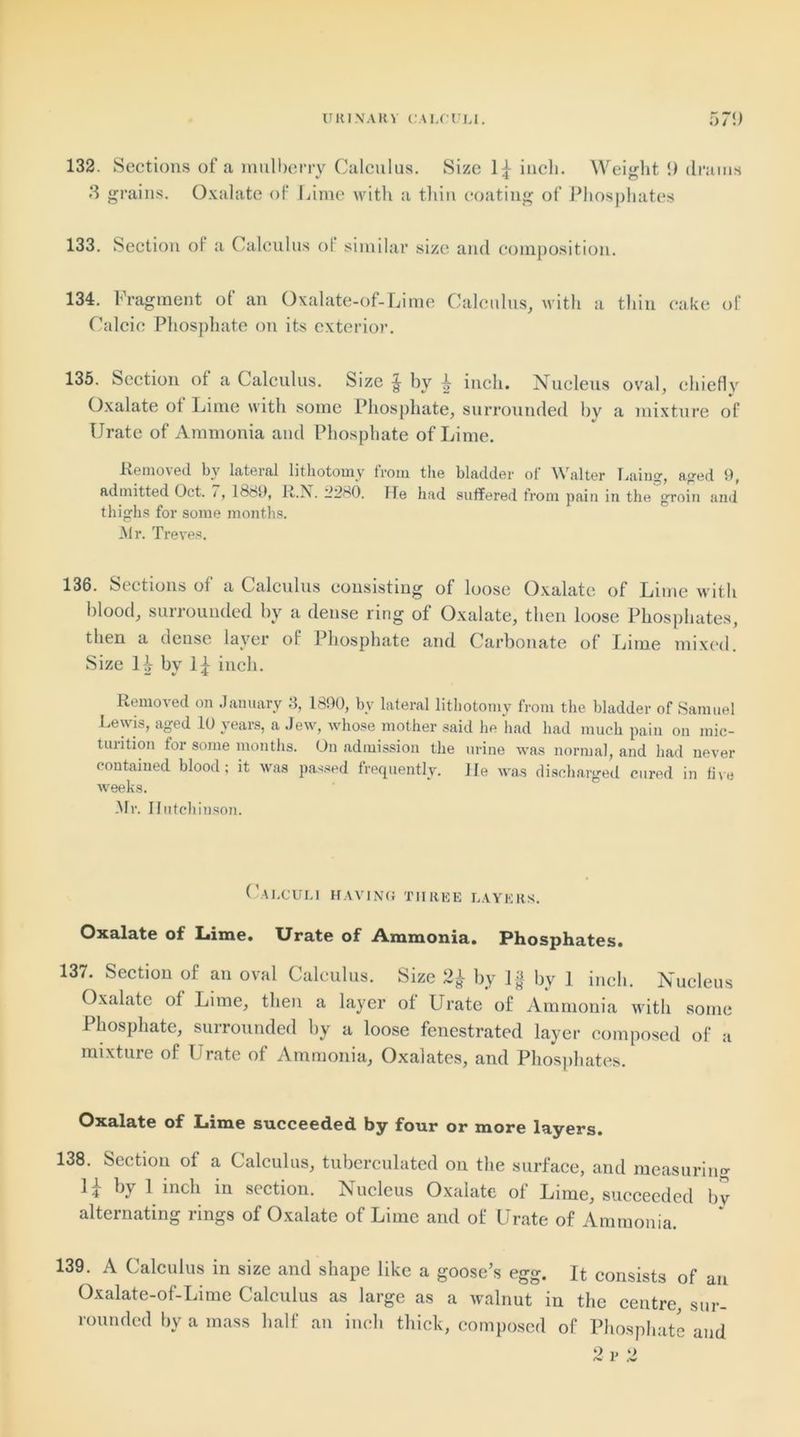 132. Sections of a mulberry Calculus. Size inch. Weight 9 drams 3 grains. Oxalate of Lime with a thin coating of Phosphates 133. Section of a Calculus of similar size and composition. 134. Fragment of an Oxalate-of-Lime Calculus, with a thin cake of Calcic Phosphate on its exterior. 135. Section of a Calculus. Size ^ by ^ inch. Nucleus oval, chiefly Oxalate ot Lime with some Phosphate, surrounded by a mixture of Urate of Ammonia and Phosphate of Lime. Removed by lateral lithotomy from the bladder of W alter Laiug, aged 9, admitted Oct. i, 1889, R.N. 8280. Tie had suffered from pain in the groin and thighs for some months. Mr. Treves. 136. Sections ol a Calculus consisting of loose Oxalate of Lime with blood, surrounded by a dense ring of Oxalate, then loose Phosphates, then a dense layer of Phosphate and Carbonate of Lime mixed. Size H by 1^ inch. Removed on January 3, 1890, by lateral lithotomy from the bladder of Samuel Lewis, aged 10 years, a Jew, whose mother said lie had had much pain on mic- turition for some months. On admission the urine was normal, and had never contained blood; it was passed frequently. lie was discharged cured in five weeks. Mr. Hutchinson. Calculi having three layers. Oxalate of Lime. Urate of Ammonia. Phosphates. 137. Section of an oval Calculus. Size 2£ by 1§ bv 1 inch. Nucleus Oxalate of Lime, then a layer of Urate of Ammonia with some Phosphate, surrounded by a loose fenestrated layer composed of a mixture of Urate of Ammonia, Oxalates, and Phosphates. Oxalate of Lime succeeded by four or more layers. 138. Section of a Calculus, tuberculated on the surface, and measuring H by 1 inch in section. Nucleus Oxalate of Lime, succeeded bv alternating rings of Oxalate of Lime and of Urate of Ammonia. 139. A Calculus in size and shape like a goose’s egg. It consists of an Oxalate-of-Lime Calculus as large as a walnut in the centre, sur- rounded by a mass half an inch thick, composed of Phosphate and 2 p 2