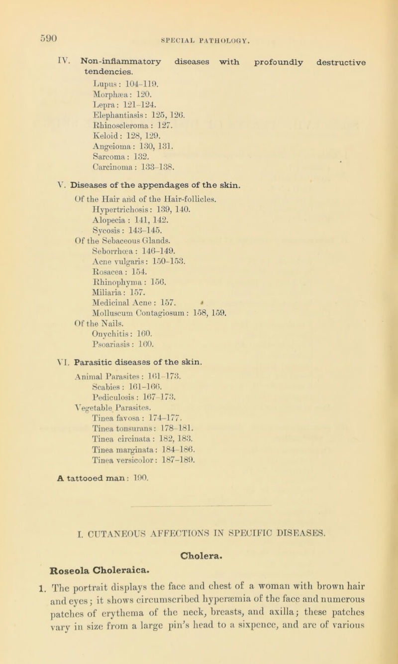 IV. Non-inflammatory diseases with profoundly destructive tendencies. Lupus: 104-119. Morpliaea: 120. Lepra: 121-124. Elephantiasis: 125,120. Rhinoscleroma: 127. Keloid: 128, 129. Angeioma: 130, 131. Sarcoma: 132. Carcinoma: 133-138. V. Diseases of the appendages of the skin. Of the Hair and of the Hair-follicles. Hypertrichosis: 139, 140. Alopecia : 141, 142. Sycosis : 143-145. Of the Sebaceous Glands. Seborrhcea: 146-149. Acne vulgaris: 150-153. Rosacea : 154. Rhinophyma: 150. Miliaria: 157. Medicinal Acne : 157. * Molluscum Contagiosum : 158, 159. Of the Nails. Onychitis: 100. Psoariasis: 100. VI. Parasitic diseases of the skin. Animal Parasites: 161-173. Scabies : 161-166. Pediculosis: 167-173. Vegetable Parasites. Tinea favosa : 174-177. Tinea tonsurans: 178-181. Tinea circinata : 182, 183. Tinea marginata: 184-186. Tinea versicolor: 187-189. A tattooed man : 190. I. CUTANEOUS AFFECTIONS IN SPECIFIC DISEASES. Cholera. Roseola Choleraica. 1. The portrait displays the face and chest of a woman with brown hair and eyes; it shows circumscribed hypersemia of the face and numerous patches of erythema of the neck, breasts, and axilla; these patches vary in size from a large pin’s head to a sixpence, and are of various
