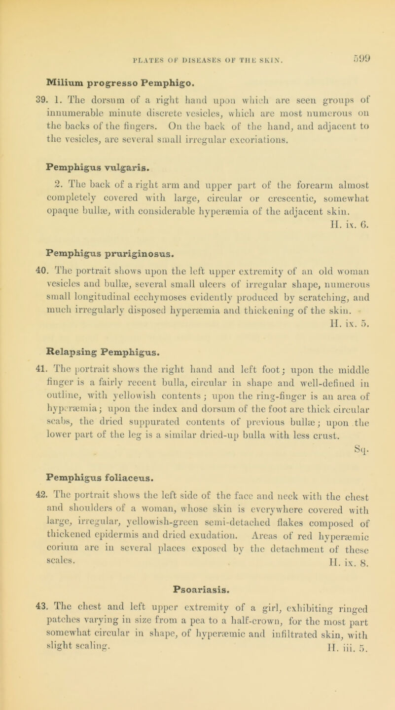 Milium progresso Pemphigo. 39. 1. The dorsum of a right hand upon which are seen groups of innumerable minute discrete vesicles, which are most numerous on the backs of the fingers. On the back of the hand, and adjacent to the vesicles, are several small irregular excoriations. Pemphigus vulgaris. 2. The back of a right arm and upper part of the forearm almost completely covered with, large, circular or crescentic, somewhat opaque bullae, with considerable hyperaemia of the adjacent skin. II. ix. 6. Pemphigus pruriginosus. 40. The portrait shows upon the left upper extremity of an old woman vesicles and bullae, several small ulcers of irregular shape, numerous small longitudinal ecchymoses evidently produced by scratching, and much irregularly disposed hypersemia and thickening of the skin. II. ix. 5. Relapsing Pemphigus. 41. The portrait shows the right hand and left foot; upon the middle finger is a fairly recent bulla, circular in shape and well-defined in outline, with yellowish contents ; upon the ring-finger is an area of hypersemia; upon the index and dorsum of the foot are thick circular scabs, the dried suppurated contents of previous bullae; upon the lower part of the leg is a similar dried-up bulla with less crust. Sq. Pemphigus foliaceus. 42. The portrait shows the left side of the face and neck with the chest and shoulders of a woman, whose skin is everywhere covered with large, irregular, yellowish-green semi-detached flakes composed of thickened epidermis and dried exudation. Areas of red liypersemic coriurn are in several places exposed by the detachment of these scales. II. ix. 8. Psoariasis. 43. The chest and left upper extremity of a girl, exhibiting ringed patches varying in size from a pea to a half-crown, for the most part somewhat circular in shape, of hypersemic and infiltrated skin, with slight scaling. ][ ^ 5
