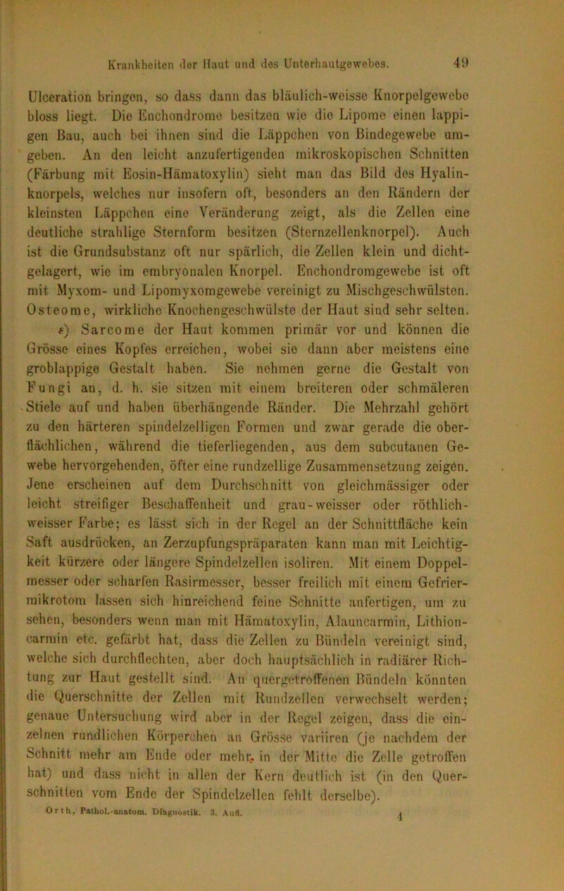 Ulceration bringen, so dass dann das bläulich-wcisse Knorpolgevvebo bloss liegt. Die Enchondromo besitzen wie die Lipome einen lappi- gen Bau, auch bei ihnen sind die Läppchen von Bindegewebe um- geben. An den leicht anzufertigenden mikroskopischen Schnitten (Färbung mit Eosin-Hämatoxylin) sieht man das Bild des Hyalin- knorpels, welches nur insofern oft, besonders an den Rändern der kleinsten Läppchen eine Veränderung zeigt, als die Zellen eine deutliche strahlige Sternform besitzen (Sternzellenknorpel). Auch ist die Grundsubstanz oft nur spärlich, die Zellen klein und dicht- gelagert, wie im embryonalen Knorpel. Enchondromgewebe ist oft mit Myxom- und Lipomyxomgewebe vereinigt zu Mischgeschwülsten. Osteome, wirkliche Knochengeschwülste der Haut sind sehr selten. f) Sarcome der Haut kommen primär vor und können die Grösse eines Kopfes erreichen, wobei sie dann aber meistens eine groblappige Gestalt haben. Sie nehmen gerne die Gestalt von Fungi an, d. h. sie sitzen mit einem breiteren oder schmäleren Stiele auf und haben überhängende Ränder. Die Mehrzahl gehört zu den härteren spindelzelligen Formen und zwar gerade die ober- tlächlichen, während die tieferliegenden, aus dem subcutanen Ge- webe hervorgehenden, öfter eine rundzellige Zusammensetzung zeigen. Jene erscheinen auf dem Durchschnitt von gleichmässiger oder leicht streifiger Beschaffenheit und grau-weisser oder röthlich- weisser Farbe; es lässt sich in der Regel an der Schnittfläche kein Saft ausdriieken, an Zerzupfungspräparaten kann man mit Leichtig- keit kürzere oder längere Spindelzellen isoliren. Mit einem Doppel- messer oder scharfen Rasirmesscr, besser freilich mit einem Gefrier- mikrotom lassen sich hinreichend feine Schnitte anfertigen, um zu sehen, besonders wenn man mit Hämatoxylin, Alauncarmin, Lithion- carmin etc. gefärbt hat, dass die Zellen zu Bündeln vereinigt sind, welche sich durchflechten, aber doch hauptsächlich in radiärer Rich- tung zur Haut gestellt sind. Au quergetroffenen Bündeln könnten die Querschnitte der Zellen mit Rundzellen verwechselt werden; genaue Untersuchung wird aber in der Regel zeigen, dass die ein- zelnen rundlichen Körperchen an Grösse variiren (je nachdem der Schnitt mehr am Ende oder mehr, in der Mitte die Zelle getroffen hat) und dass nicht in allen der Kern deutlich ist (in den Quer- schnitten vom Ende der Spindelzellen fehlt derselbe). Orth, Pathol.-anatom. DFliguostik. 3. Aurt. j