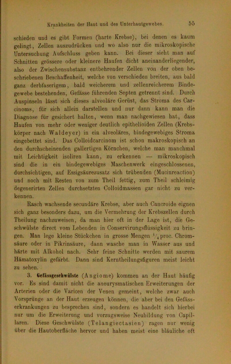 schieden und es gibt Formen (harte Krebse), bei denen es kaum gelingt, Zellen auszudrücken und wo also nur die mikroskopische Untersuchung Aufschluss geben kann. Bei dieser sieht man auf Schnitten grössere oder kleinere Haufen dicht aneinanderliegender, also der Zwischensubstanz entbehrender Zellen von der oben be- schriebenen Beschaffenheit, welche von verschieden breiten, aus bald ganz derbfaserigem, bald weicherem und zellenreicherem Binde- gewebe bestehenden, Gefässe führenden Septen getrennt sind. Durch Auspinseln lässt sich dieses alveoläre Gerüst, das Stroma des Car- cinoras, für sich allein darstellen und nur dann kann man die Diagnose für gesichert halten, wenn man nachgewiesen hat, dass Haufen von mehr oder weniger deutlich epithelioiden Zellen (Krebs- körper nach Waldeyer) in ein alveoläres, bindegewebiges Stroma eingebettet sind. Das Colloidcarcinom ist schon makroskopisch an den durchscheinenden gallertigen Körnchen, welche man manchmal mit Leichtigkeit isoliren kann, zu erkennen — mikroskopisch sind die in ein bindegewebiges Maschenwerk eingeschlossenen, durchsichtigen, auf Essigsäurezusatz sich trübenden (Mucinreaction) und noch mit Resten von zum Theil fettig, zum Theil schleimig degenerirten Zellen durchsetzten Colloidmassen gar nicht zu ver- kennen. Rasch wachsende secundäre Krebse, aber auch Cancroide eignen sich ganz besonders dazu, um die Vermehrung der Krebszellen durch Theilung nachzuweisen, da man hier oft in der Lage ist, die Ge- schwülste direct vom Lebenden in Conservirungsfliissigkeit zu brin- gen. Man lege kleine Stückchen in grosse Mengen l/4proc. Chrom- säure oder in Pikrinsäure, dann wasche man in Wasser aus und härte mit Alkohol nach. Sehr feine Schnitte werden mit saurem Hämatoxylin gefärbt. Dann sind Kerntheilungsfiguren meist leicht zu sehen. 3. Gefässgcsehwnlstc (Angiome) kommen an der Haut häufig vor. Es sind damit nicht die aneurysmatischon Erweiterungen der Arterien oder die Varicen der Venen gemeint, welche zwar auch Vorsprünge an der Haut erzeugen können, die aber bei den Gefäss- erkrankungen zu besprechen sind, sondern es handelt sich hierbei nur um die Erweiterung und vorzugsweise Neubildung von Capil- laren. Diese Geschwülste (Telangiectasion) ragen nur wenig über die Hautobertiäche hervor und haben meist eine bläuliche oft