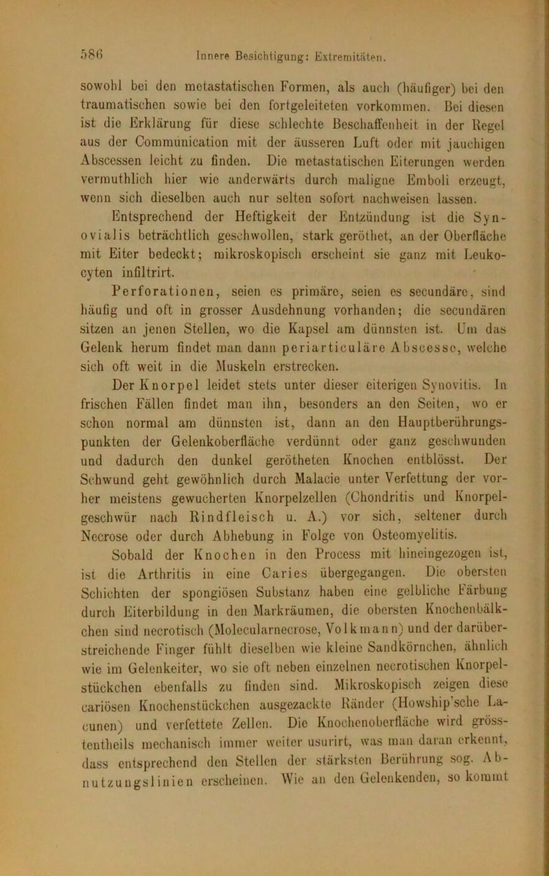 sowohl bei den metastatischen Formen, als auch (häufiger) bei den traumatischen sowie bei den fortgeleiteten Vorkommen. Bei diesen ist die Erklärung für diese schlechte Beschaffenheit in der Regel aus der Communication mit der äusseren Luft oder mit jauchigen Abscessen leicht zu finden. Die metastatischen Eiterungen werden vermuthlich hier wie anderwärts durch maligne Emboli erzeugt, wenn sich dieselben auch nur selten sofort nachweisen lassen. Entsprechend der Heftigkeit der Entzündung ist die Syn- ovialis beträchtlich geschwollen, stark geröthet, an der Oberfläche mit Eiter bedeckt; mikroskopisch erscheint sie ganz mit Leuko- cyten infiltrirt. Perforationen, seien es primäre, seien es secundäre, sind häufig und oft in grosser Ausdehnung vorhanden; die secundären sitzen an jenen Stellen, wo die Kapsel am dünnsten ist. Um das Gelenk herum findet man dann periartieuläre Abscesse, welche sich oft weit in die Muskeln erstrecken. Der Knorpel leidet stets unter dieser eiterigen Synovitis. ln frischen Fällen findet man ihn, besonders an den Seiten, wo er schon normal am dünnsten ist, dann an den Hauptberührungs- punkten der Gelenkoberfläche verdünnt oder ganz geschwunden und dadurch den dunkel gerötheten Knochen entblösst. Der Schwund geht gewöhnlich durch Malacie unter Verfettung der vor- her meistens gewucherten Knorpelzellen (Chondritis und Knorpel- geschwür nach Rindfleisch u. A.) vor sich, seltener durch Necrose oder durch Abhebung in Folge von Osteomyelitis. Sobald der Knochen in den Process mit hineingezogen ist, ist die Arthritis in eine Caries übergegangen. Die obersten Schichten der spongiösen Substanz haben eine gelbliche bärbung durch Eiterbildung in den Markräumen, die obersten Knochenbälk- chen sind neerotisch (Molecularnecrose, Volk mann) und der darüber- streichende Finger fühlt dieselben wie kleine Sandkörnchen, ähnlich wie im Gelenkeiter, wo sie oft neben einzelnen necrotischen Knorpel- stückchen ebenfalls zu finden sind. Mikroskopisch zeigen diese cariösen Knochenstückchen ausgezackte Ränder (Howship sehe La- cunen) und verfettete Zellen. Die Knochenoberfläche wird gröss- tentheils mechanisch immer weiter usurirt, was man daran erkennt, dass entsprechend den Stellen der stärksten Berührung sog. Ab- nutzungslinien erscheinen. Wie an den Gelenkenden, so kommt