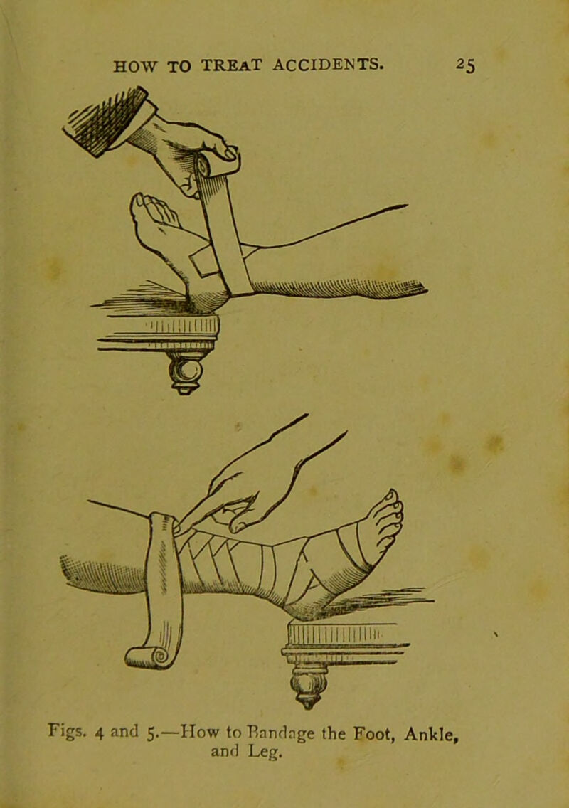 Figs. 4 and 5.—How to Bandage the Foot, Ankle, and Leg.