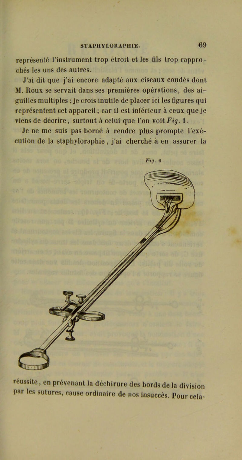 représenté l’instrument trop étroit et les fils trop rappro- chés les uns des autres. J’ai dit que j’ai encore adapté aux ciseaux coudés dont M. Roux se servait dans ses premières opérations, des ai- guilles multiples ; je crois inutile de placer ici les figures qui représentent cet appareil ; car il est inférieur à ceux que je viens de décrire, surtout à celui que l'on voit Fig. 1. Je ne me suis pas borné à rendre plus prompte l’exé- cution de la staphyloraphie, j’ai cherché à en assurer la Fig. 6 réussite, en prévenant la déchirure des bords de la division par les sutures, cause ordinaire de nos insuccès. Pour cela-
