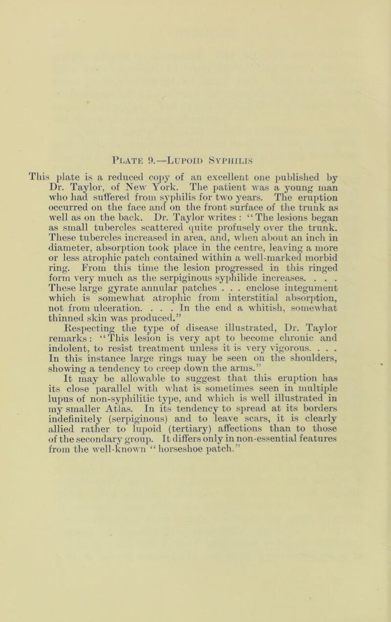 Plate 9.—Lupoid Syphilis This plate is a reduced copy of an excellent one published by Dr. Taylor, of New York. The patient was a young man who had suffered from syphilis for two years. The eruption occurred on the face and on the front surface of the trunk as well as on the back. Dr. Taylor writes : “ The lesions began as small tubercles scattered quite profusely over the trunk. These tubercles increased in area, and, when about an inch in diameter, absorption took place in the centre, leaving a more or less atrophic patch contained within a well-marked morbid ring. From this time the lesion progressed in this ringed form very much as the serpiginous syphilide increases. . . . These large gyrate annular patches . . . enclose integument which is somewhat atrophic from interstitial absorption, not from ulceration. ... In the end a whitish, somewhat thinned skin was produced.” Respecting the type of disease illustrated, Dr. Taylor remarks: “This lesion is very apt to become chronic and indolent, to resist treatment unless it is very vigorous. . . . In this instance large rings may be seen on the shoulders, showing a tendency to creep down the arms.” It may be allowable to suggest that this eruption has its close parallel with what is sometimes seen in multiple lupus of non-sypliilitic type, and which is well illustrated in my smaller Atlas. In its tendency to spread at its borders indefinitely (serpiginous) .and to leave scars, it is clearly allied rather to lupoid (tertiary) affections than to those of the secondary group. It differs only in non-essential features from the well-known “horseshoe patch.”