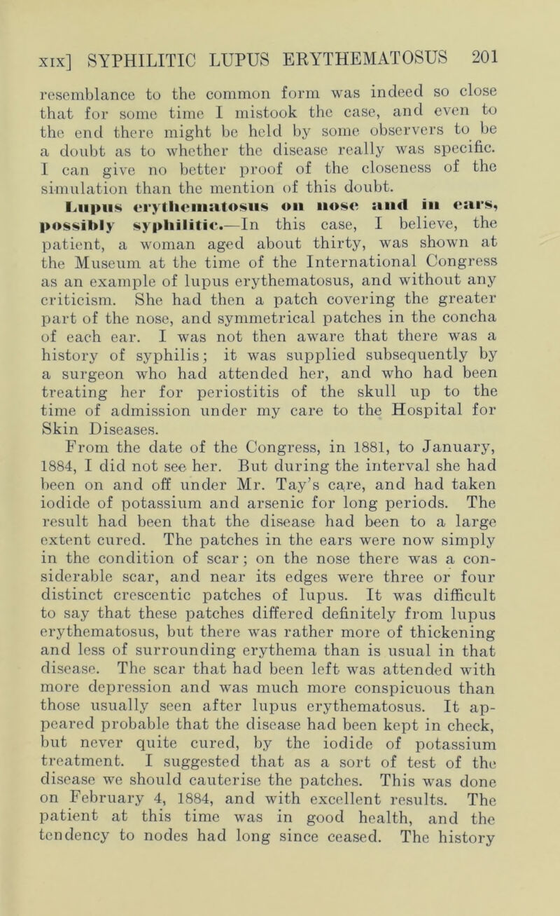 resemblance to the common form was indeed so close that for some time I mistook the case, and even to the end there might be held by some observers to be a doubt as to whether the disease really was specific. I can give no better proof of the closeness of the simulation than the mention of this doubt. Lupus erythematosus oil nose s*n«I in ears, possibly syphilitic.—In this case, I believe, the patient, a woman aged about thirty, was shown at the Museum at the time of the International Congress as an example of lupus erythematosus, and without any criticism. She had then a patch covering the greater part of the nose, and symmetrical patches in the concha of each ear. I was not then aware that there was a history of syphilis; it was supplied subsequently by a surgeon who had attended her, and who had been treating her for periostitis of the skull up to the time of admission under my care to the Hospital for Skin Diseases. From the date of the Congress, in 1881, to January, 1884, I did not see her. But during the interval she had been on and off under Mr. Tay’s care, and had taken iodide of potassium and arsenic for long periods. The result had been that the disease had been to a large extent cured. The patches in the ears were now simply in the condition of scar; on the nose there was a con- siderable scar, and near its edges were three or four distinct crescentic patches of lupus. It was difficult to say that these patches differed definitely from lupus erythematosus, but there was rather more of thickening and less of surrounding erythema than is usual in that disease. The scar that had been left was attended with more depression and was much more conspicuous than those usually seen after lupus erythematosus. It ap- peared probable that the disease had been kept in check, but never quite cured, by the iodide of potassium treatment. I suggested that as a sort of test of the disease we should cauterise the patches. This was done on February 4, 1884, and with excellent results. The patient at this time was in good health, and the tendency to nodes had long since ceased. The history