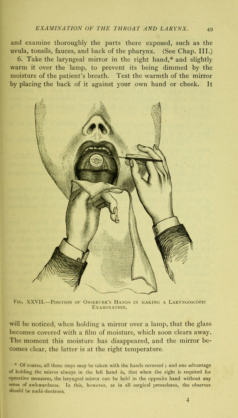 and examine thoroughly the parts there exposed, such as the uvula, tonsils, fauces, and back of the pharynx. (See Chap. III.) 6. Take the laryngeal mirror in the right hand,* and slightly warm it over the lamp, to prevent its being dimmed by the moisture of the patient’s breath. Test the warmth of the mirror by placing the back of it against your own hand or cheek. It Fig. XXVII.—Position ok Observer’s Hands in making a Laryngoscopic Examination. will be noticed, when holding a mirror over a lamp, that the glass becomes covered with a film of moisture, which soon clears away. The moment this moisture has disappeared, and the mirror be- comes clear, the latter is at the right temperature. * Of course, all these steps may be taken with the hands reversed ; and one advantage of holding the mirror always in the left hand is, that when the right is required for operative measures, the laryngeal mirror can be held in the opposite hand without any sense of awkwardness. In this, however, as in all surgical procedures, the observer should be ambi-dextrous. 4