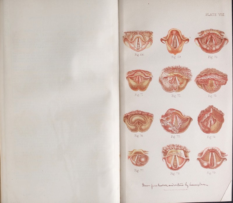 Tig. 74. Tig. 76. Eg.'78. Tig.73. |w- /p^Imvju 4^ Lu****y