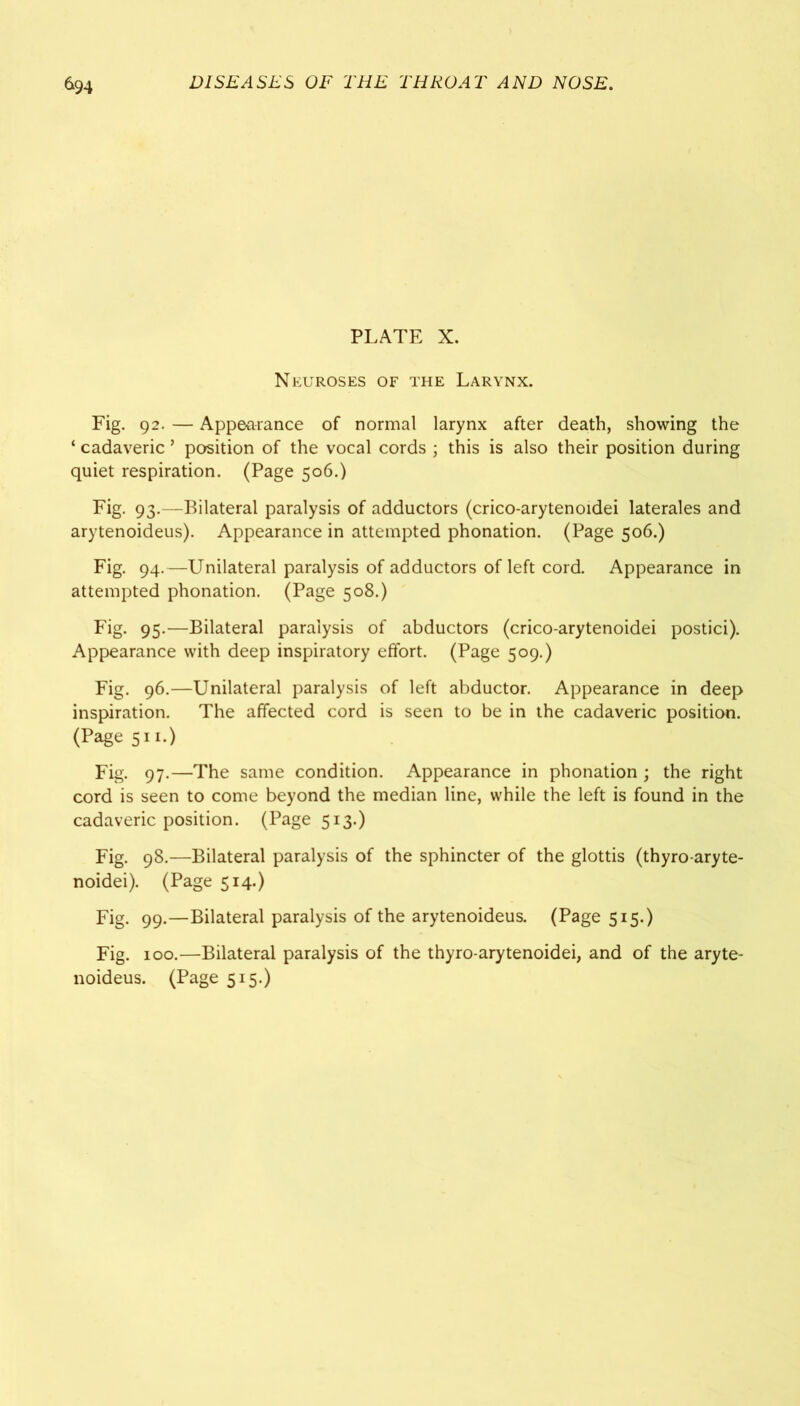 PLATE X. Neuroses of the Larynx. Fig. 92. — Appearance of normal larynx after death, showing the ‘ cadaveric ’ position of the vocal cords ; this is also their position during quiet respiration. (Page 506.) Fig. 93.—Bilateral paralysis of adductors (crico-arytenoidei laterales and arytenoideus). Appearance in attempted phonation. (Page 506.) Fig. 94.—Unilateral paralysis of adductors of left cord. Appearance in attempted phonation. (Page 508.) Fig. 95.—Bilateral paralysis of abductors (crico-arytenoidei postici). Appearance with deep inspiratory effort. (Page 509.) Fig. 96.—Unilateral paralysis of left abductor. Appearance in deep inspiration. The affected cord is seen to be in the cadaveric position. (Page 511.) Fig. 97.—The same condition. Appearance in phonation ; the right cord is seen to come beyond the median line, while the left is found in the cadaveric position. (Page 513.) Fig. 98.—Bilateral paralysis of the sphincter of the glottis (thyro-aryte- noidei). (Page 514.) Fig- 99-—Bilateral paralysis of the arytenoideus. (Page 515.) Fig. 100.—Bilateral paralysis of the thyro-arytenoidei, and of the aryte- noideus. (Page 515.)