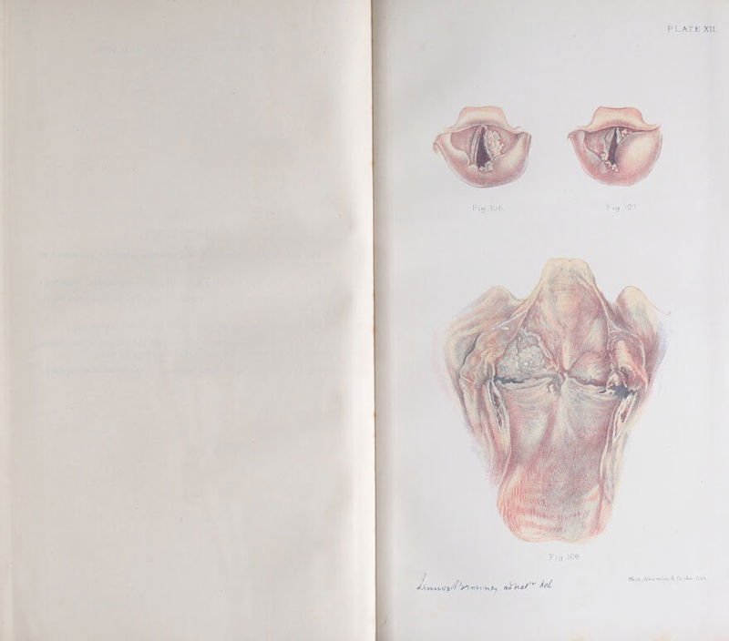 Fig. 108. ijUvwTf/t VwM/Vv/y M■ W&st, Mew/ruin, 8c Co.tHo • Lith