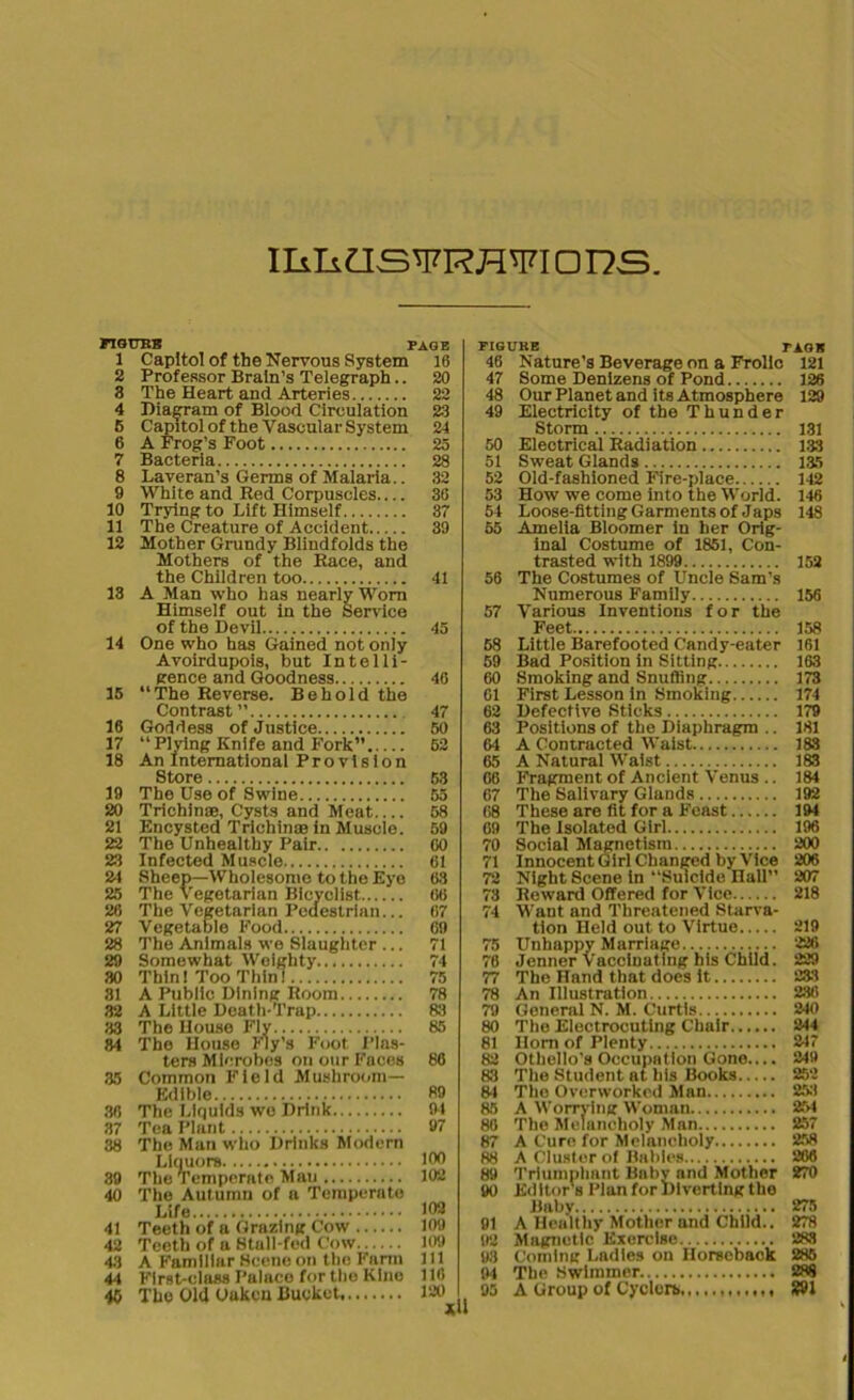 mkas^RH^ioDs FIGURE PAGE 1 Capitol of the Nervous System 16 2 Professor Brain’s Telegraph.. 20 3 The Heart and Arteries 22 4 Diagram of Blood Circulation 23 6 Capitol of the Vascular System 24 6 A Frog’s Foot 25 7 Bacteria 28 8 Laveran’s Germs of Malaria.. 32 9 White and Red Corpuscles 36 10 Trying to Lift Himself 37 11 The Creature of Accident 39 12 Mother Grundy Blindfolds the Mothers of the Race, and the Children too 41 13 A Man who has nearly Worn Himself out in the Service of the Devil 45 14 One who has Gained not only Avoirdupois, but Intelli- gence and Goodness 46 15 “The Reverse. Behold the Contrast” 47 16 Goddess of Justice 50 17 “Plving Knife and Fork” 52 18 An International Provision Store 53 19 The Use of Swine 55 20 Trichinae, Cysts and Meat 58 21 Encysted Trichinae in Muscle. 59 22 The Unhealthy Pair 60 23 Infected Muscle 61 21 Sheep—Wholesome to the Eye 63 25 The Vegetarian Bicyclist. 66 26 The Vegetarian Pedestrian... 67 27 Vegetable Food 69 28 The Animals we Slaughter ... 71 29 Somewhat Weighty 74 30 Thin! Too Thin! 75 31 A Public Dining Room 78 32 A Little Death-Trap 83 33 The House Fly 85 84 The House Fly’s Foot Pias- ters Microbes on our Faces 86 35 Common Field Mushroom- Edible 89 30 The Liquids wo Drink 94 37 Tea Plant 97 38 The Man who Drinks Modern Liquors 100 39 The Temperate Mau 102 40 The Autumn of a Temperate Life 108 41 Teeth of a Grazing Cow 109 42 Teeth of a Stall-fed Cow 109 43 A Familiar Scene on the Farm 111 4-1 First-class Palace for the KIne 116 40 The Old Uukcn Bucket 120 FIGURE TAGS 46 Nature's Beverage on a Frolic 121 47 Some Denizens of Pond 126 48 Our Planet and its Atmosphere 129 49 Electricity of the Thunder Storm 131 50 Electrical Radiation 133 51 Sweat Glands 135 52 Old-fashioned Fire-place 112 53 How we come into the World. 146 54 Loose-fitting Garments of Japs 148 55 Amelia Bloomer in her Orig- inal Costume of 1851, Con- trasted with 1899 152 56 The Costumes of Uncle Sam’s Numerous Family 156 57 Various Inventions for the Feet 158 68 Little Barefooted Candy-eater 161 59 Bad Position in Sitting 163 60 Smoking and Snuffing 173 61 First Lesson in Smoking 174 62 Defective Sticks 179 63 Positions of the Diaphragm .. 181 64 A Contracted Waist 183 65 A Natural Waist 183 66 Fragment of Ancient Venus .. 184 67 The Salivary Glands 192 68 These are fit for a Feast 194 69 The Isolated Girl 196 70 Social Magnetism 200 71 Innocent Girl Changed by Vice 206 72 Night Scene in “Suicide. Hall” 207 73 Reward Offered for Vice 218 74 Want and Threatened Starva- tion Held out to Virtue 219 75 Unhappy Marriage 226 76 Jenner Vaccinating his Child. 229 77 The Hand that does it 233 78 An Illustration 236 79 General N. M. Curtis 240 80 The Electrocuting Chair 244 81 Horn of Plenty 247 82 Othello's Occupation Gone.... 249 83 The Student at his Books 252 81 The Overworked Man 253 85 A Worrying Woman 254 80 The Melancholy Man 257 87 A Cure for Melancholy 258 88 A Cluster of Babies 286 89 Triumphant Baby and Mother 270 90 Editor's Plan for Inverting the Baby 275 91 A Healthy Mother and Child.. 278 92 Magnetic Exercise 288 93 Coming Ladies on Horseback 285 84 The Swimmer 288 95 A Group of Cyclers, %91