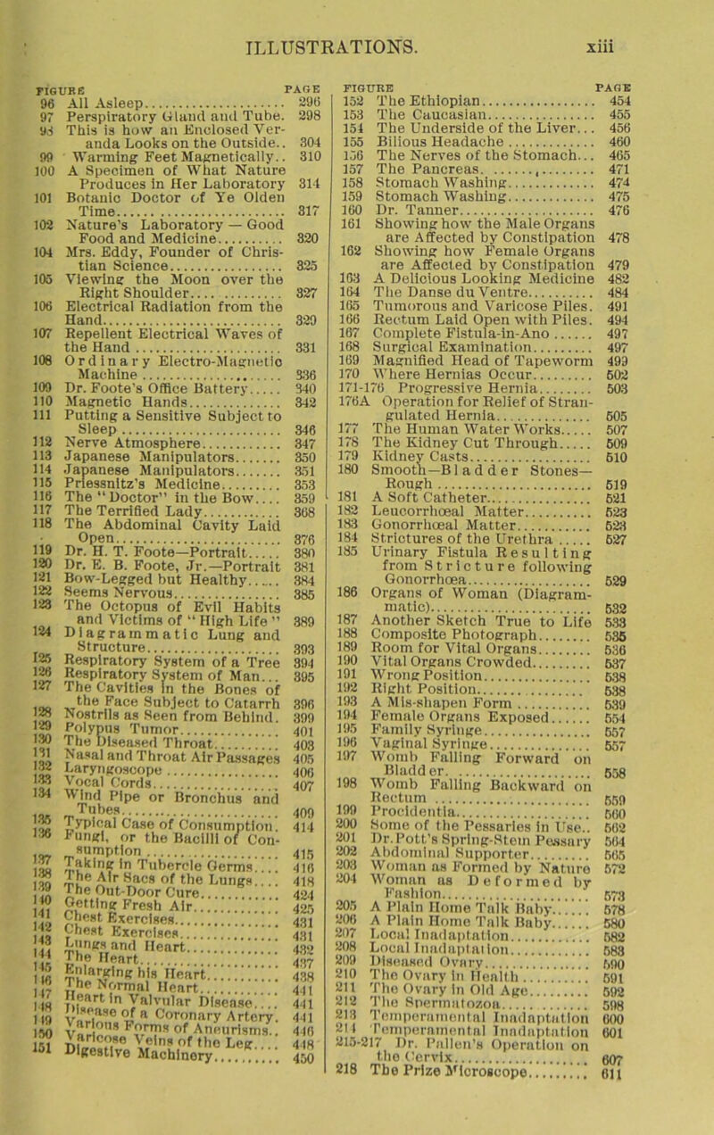 FIGURE PAGE 96 All Asleep 296 97 Perspiratory Gland and Tube. 298 98 This is how an Enclosed Ver- anda Looks on the Outside.. 304 99 Warming Feet Magnetically.. 310 100 A Specimen of What Nature Produces in Her Laboratory 314 101 Botanic Doctor of Ye Olden Time 317 102 Nature’s Laboratory — Good Food and Medicine 320 104 Mrs. Eddy, Founder of Chris- tian Science 325 105 Viewing the Moon over the Right Shoulder 327 106 Electrical Radiation from the Hand 329 107 Repellent Electrical Waves of the Hand 331 108 O r d in a r y Electro-Magnetic Machine 336 109 Dr. Foote’s Office Battery 340 110 Magnetic Hands ' 342 111 Putting a Sensitive Subject to Sleep 346 112 Nerve Atmosphere 347 113 Japanese Manipulators 350 114 Japanese Manipulators 351 115 Prtessnltz’s Medicine 353 116 The “Doctor” in the Bow.... 359 117 The Terrified Lady 368 118 The Abdominal Cavity Laid ■ Open 376 119 Dr. H. T. Foote—Portrait 380 120 Dr. E. B. Foote, Jr.—Portrait 381 121 Bow-Legged but Healthy 384 122 Seems Nervous 385 123 The Octopus of Evil Habits and Victims of “ High Life ” 389 124 Diagrammatic Lung and Structure 393 125 Respiratory System of a Tree 394 126 Respiratory System of Man... 395 127 The Cavities in the Bones of .oo „.the £ace Subject to Catarrh 396 j'2 Nostrils as Seen from Behind. 399 5 Po|ypus Tumor 401 !?? The Oiseased Throat 403 loo ■',a<*al and Throat Air Passages 405 m laryngoscope 406 ™ Vocal Cords 407 134 Mind Pipe or Bronchus and Tubes 400 Typical Case of Consumption. 414 156 Fungi, or the Bacilli of Con- sumption 4)5 £ Taking in Tubercle Germs.... 416 ito rj,u Sacs of the Lungs 413 The Out-Door Cure 424 ]? Fresh Alt 425 1! £hfist Exercises 43] J1? C-hest Exercises 431 44 £,'n<-'sand Heart  432 44 The Heart 437 1 (6 Tn lne l,l* Heart 438 0 The Normal Heart 441 | },eart In Valvular Disease.'.!: 441 119 v.,h a c°r°nary Artery. 441 150 Vsrio^a Forms of Aneurisms.. 446 151 TinJlaM86 \a|ns of the Leg 448 Digestive Machinery 450 FIGURE PAGE 152 The Ethiopian 454 153 The Caucasian 455 154 The Underside of the Liver... 456 155 Bilious Headache 460 156 The Nerves of the Stomach... 465 157 The Pancreas , 471 158 Stomach Washing 474 159 Stomach Washing 475 160 Dr. Tanner 476 161 Showing how the Male Organs are Affected by Constipation 478 162 Showing how Female Organs are Affected by Constipation 479 163 A Delicious Looking Medicine 482 164 The Danse du Ventre 484 165 Tumorous and Varicose Piles. 491 166 Rectum Laid Open with Piles. 494 167 Complete Fistula-in-Ano 497 168 Surgical Examination 497 169 Magnified Head of Tapeworm 499 170 Where Hernias Occur 602 171-176 Progressive Hernia 503 176A Operation for Relief of Stran- gulated Hernia 505 177 The Human Water Works 507 178 The Kidney Cut Through 609 179 Kidney Casts 610 180 Smooth—B1 ad d er Stones— Rough 519 181 A Soft Catheter 521 182 Leucorrhoeal Matter 523 183 Gonorrhoeal Matter 623 184 Strictures of the Urethra 627 185 Urinary Fistula Resulting from Stricture following Gonorrhoea 529 186 Organs of Woman (Diagram- matic) 532 187 Another Sketch True to Life 533 188 Composite Photograph 535 189 Room for Vital Organs 536 190 Vital Organs Crowded 537 191 Wrong Position 538 192 Right Position 538 193 A Mis-shapen Form 539 194 Female Organs Exposed 554 195 Family Syringe 557 196 Vaginal Syringe 557 197 Womb Falling Forward on Bladder 558 198 Womb Falling Backward on Rectum 559 199 Procidentia :.: 560 200 Some of the Pessaries in Use.. 562 201 Dr.Pott’s Spring-Stem Pessary 504 202 Abdominal Supporter 565 203 Woman as Formed by Nature 572 204 Woman as Deformed by Fashion 573 205 A Plain Home Talk Baby..578 206 A Plain Home Talk Baby 580 207 Looal In adaptation 582 208 Local Inadaptation 583 209 Diseased Ovary 590 210 The Ovary in Health 591 214 The Ovary in Old Age 592 212 The Spermatozoa. 598 213 Temperamental Inadaptatlon 600 214 Temperamental Inadaptatlon 601 215-217 Dr. Pullen's Operation on the Cervix 607 218 The Prize Microscope oil