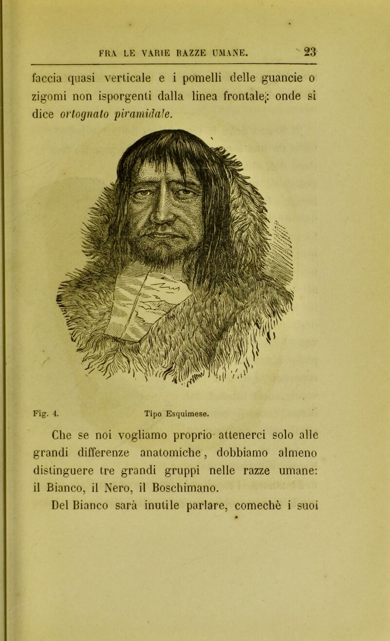 faccia quasi verticale e i pomelli delle giiancie o zigomi non isporgenti dalla linea frontale;: onde si dice orlognalo piramidaìe. Fig. 4. Tipo Esquimese. Che se noi vogliamo proprio attenerci solo alle grandi differenze anatomiche, dobbiamo almeno distinguere tre grandi gruppi nelle razze umane: il Bianco, il Nero, il Boschimano. Del Bianco sarà inutile parlare, comechè i suoi