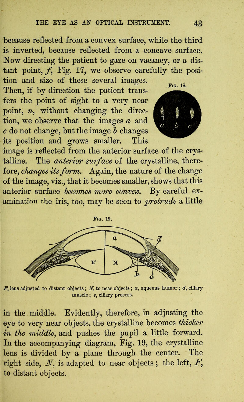 because reflected from a convex surface, while the third is inverted, because reflected from a concave surface. Now directing the patient to gaze on vacancy, or a dis- tant point, f Fig. 17, we observe carefully the posi- tion and size of these several images. Then, if by direction the patient trans- fers the point of sight to a very near point, n, without changing the direc- tion, we observe that the images a and c do not change, but the image b changes its position and grows smaller. This image is reflected from the anterior surface of the crys- talline. The anterior surface of the crystalline, there- fore, changes its form. Again, the nature of the change of the image, viz., that it becomes smaller, shows that this anterior surface becomes more convex. By careful ex- amination the iris, too, may be seen to protrude a little Fig. 19. F, lens adjusted to distant objects; 2T, to near objects; a, aqueous humor; d, ciliary- muscle ; e, ciliary process. Fig. 18. in the middle. Evidently, therefore, in adjusting the eye to very near objects, the crystalline becomes thicker in the middle, and pushes the pupil a little forward. In the accompanying diagram, Fig. 19, the crystalline lens is divided by a plane through the center. The right side, A, is adapted to near objects; the left, Fy to distant objects.