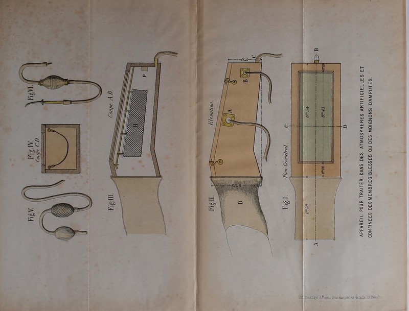 Fig. IV. Coupe CD. CONFINÉES DES MEMBRES BLESSÉS dU DES MOIGNONS D’AMPUTÉS.