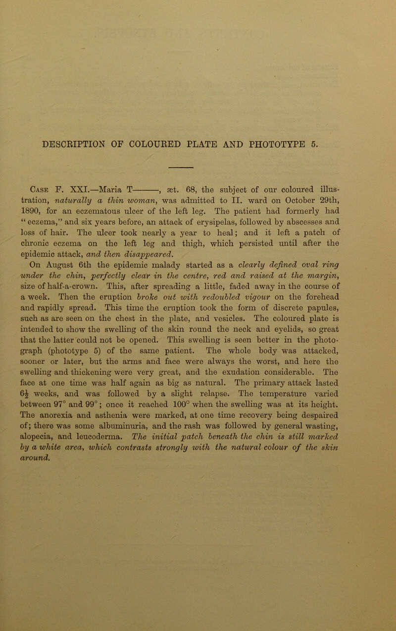 Case F. XXI.—Maria T , set. 68, the subject of our coloured illus- tration, naturally a thin ivoman, was admitted to II. ward on October 29th, 1890, for an eczematous ulcer of the left leg. The patient had formerly had “ eczema,” and six years before, an attack of erysipelas, followed by abscesses and loss of hair. The ulcer took nearly a year to heal; and it left a patch of chronic eczema on the left leg and thigh, which persisted until after the epidemic attack, and then disappeared. On August 6th the epidemic malady started as a clearly defined oval ring under the chin, perfectly clear in the centre, red and raised at the margin, size of half-a-crown. This, after spreading a little, faded away in the course of a week. Then the eruption broke out with redoubled vigour on the forehead and rapidly spread. This time the eruption took the form of discrete papules, such as are seen on the chest in the plate, and vesicles. The coloured plate is intended to show the swelling of the skin round the neck and eyelids, so great that the latter could not be opened. This swelling is seen better in the photo- graph (phototype 5) of the same patient. The whole body was attacked, sooner or later, but the arms and face were always the worst, and here the swelling and thickening were very great, and the exudation considerable. The face at one time was half again as big as natural. The primary attack lasted 6^ weeks, and was followed by a slight relapse. The temperature varied between 97° and 99°; once it reached 100° when the swelling was at its height. The anorexia and asthenia were marked, at one time recovery being despaired of; there was some albuminuria, and the rash was followed by general wasting, alopecia, and leucoderma. The initial patch beneath the chin is still marked by a white area, which contrasts strongly with the natural colour of the skin around.