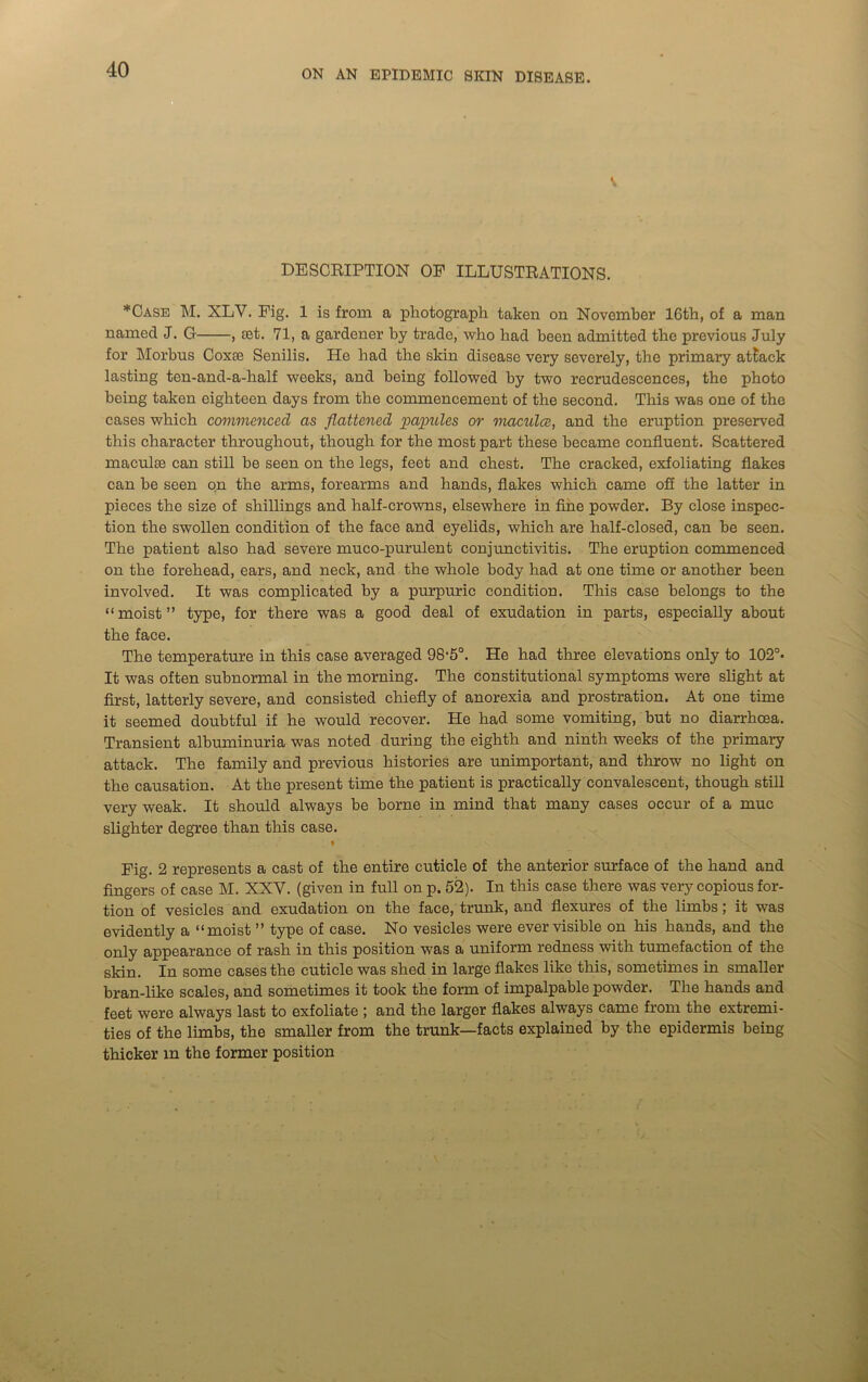 DESCRIPTION OP ILLUSTRATIONS. *Case M. XLV. Pig. 1 is from a photograph taken on November 16th, of a man named J. G , set. 71, a gardener by trade, who had been admitted the previous July for Morbus Coxse Senilis. He had the skin disease very severely, the primary attack lasting ten-and-a-half weeks, and being followed by two recrudescences, the photo being taken eighteen days from the commencement of the second. This was one of the cases which commenced as flattened papules or maculae, and the eruption preserved this character throughout, though for the most part these became confluent. Scattered maculae can still be seen on the legs, feet and chest. The cracked, exfoliating flakes can be seen on the arms, forearms and hands, flakes which came off the latter in pieces the size of shillings and half-crowns, elsewhere in fine powder. By close inspec- tion the swollen condition of the face and eyelids, which are half-closed, can be seen. The patient also had severe muco-purulent conjunctivitis. The eruption commenced on the forehead, ears, and neck, and the whole body had at one time or another been involved. It was complicated by a purpuric condition. This case belongs to the “moist” type, for there was a good deal of exudation in parts, especially about the face. The temperature in this case averaged 98-5°. He had three elevations only to 102°. It was often subnormal in the morning. The constitutional symptoms were slight at first, latterly severe, and consisted chiefly of anorexia and prostration. At one time it seemed doubtful if he would recover. He had some vomiting, but no diarrhoea. Transient albuminuria was noted during the eighth and ninth weeks of the primary attack. The family and previous histories are unimportant, and throw no light on the causation. At the present time the patient is practically convalescent, though still very weak. It should always be borne in mind that many cases occur of a muc slighter degree than this case. * .x _ ♦ • Fig. 2 represents a cast of the entire cuticle of the anterior surface of the hand and fingers of case M. XXV. (given in full on p. 52). In this case there was very copious for- tion of vesicles and exudation on the face, trunk, and flexures of the limbs; it was evidently a “moist ” type of case. No vesicles were ever visible on his hands, and the only appearance of rash in this position was a uniform redness with tumefaction of the skin. In some cases the cuticle was shed in large flakes like this, sometimes in smaller bran-like scales, and sometimes it took the form of impalpable powder. The hands and feet were always last to exfoliate ; and the larger flakes always came from the extremi- ties of the limbs, the smaller from the trunk—facts explained by the epidermis being thicker in the former position