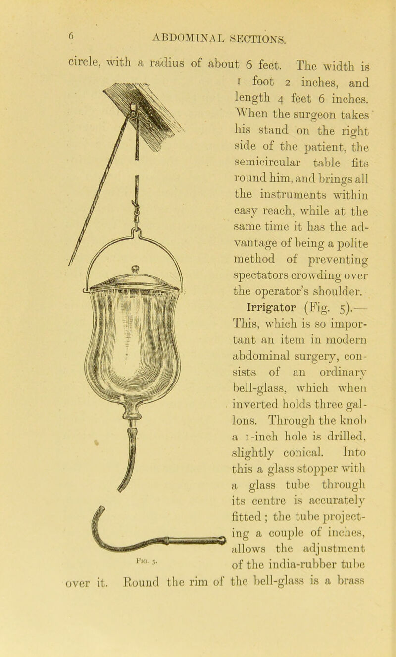 citcIg, with B. rjidius of cibout 6 foot. Tli6 width is I foot 2 inches, and length ^ feet 6 inches. When the surgeon takes his stand on the rialit o side of the j^atient, the semicircular table fits round him, and brings all the instruments within easy reach, while at the same time it has the ad- vantage of being a polite method of preventing spectators crowding over the operator’s shoulder. Irrigator (Fig. 5).— This, which is so impor- tant an item in modern abdominal surgery, con- sists of an ordinary bell-glass, which when inverted holds three gal- lons. Through the knol) a I-inch hole is drilled, slightly conical. Into this a glass stopper with a glass tube through its centre is accurately fitted ; the tube project- ing a couple of inches, allows the adjustment of the india-rubber tube the rim of the bell-glass is a Ijrass l-'io. 5. over it. Round