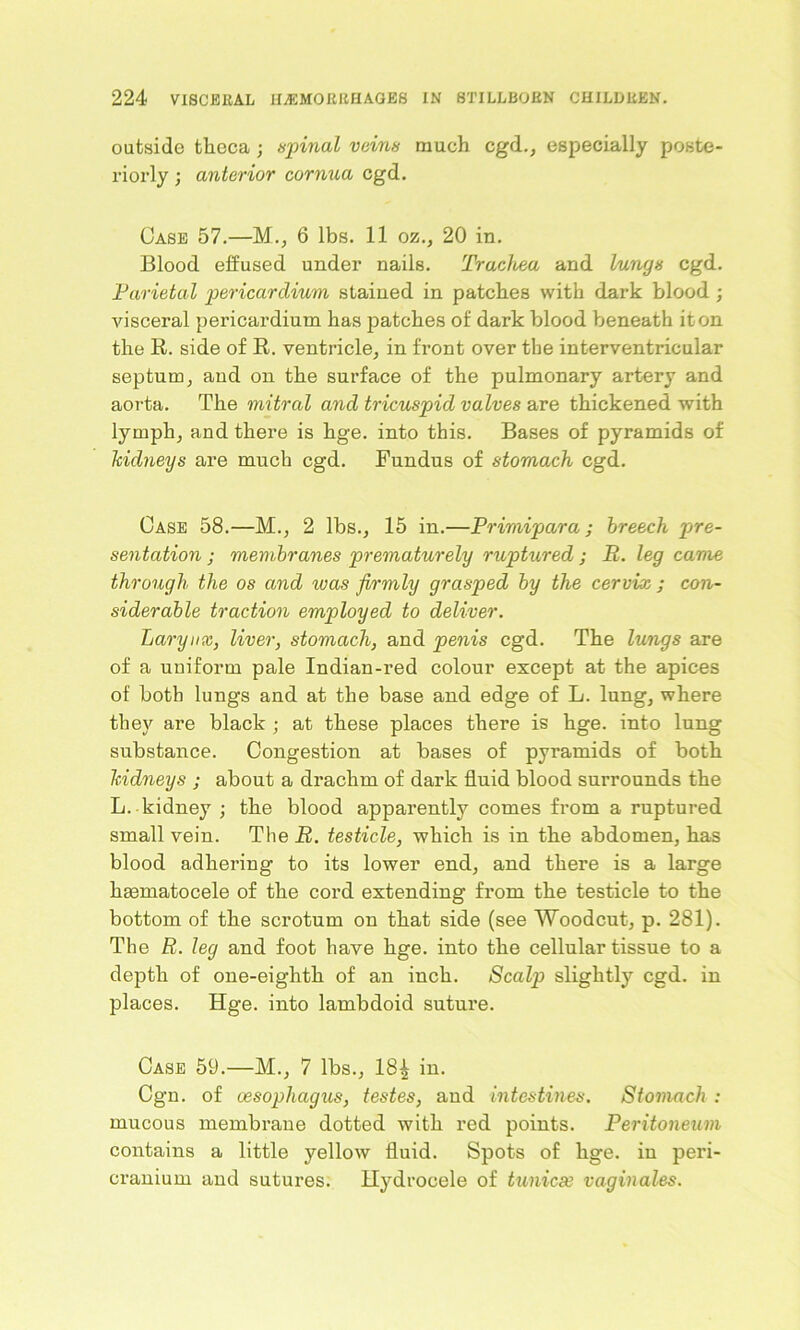 outside theca; spinal veins much cgd., especially poste- riorly ; anterior cornua cgd. Case 57.—M., 6 lbs. 11 oz., 20 in. Blood effused under nails. Trachea and lungs cgd. Parietal pericardium stained in patches with dark blood ; visceral pericardium has patches of dark blood beneath it on the R. side of R. ventricle, in front over the interventricular septum, and on the surface of the pulmonary artery and aorta. The mitral and tricuspid valves are thickened with lymph, and there is hge. into this. Bases of pyramids of kidneys are much cgd. Fundus of stomach cgd. Case 58.—M., 2 lbs., 15 in.—Primipara ; breech pre- sentation ; membranes prematurely ruptured ; If. leg came through the os and was firmly grasped by the cervix ; con- siderable traction emp>loyed to deliver. Larynx, liver, stomach, and penis cgd. The lungs are of a uniform pale Indian-red colour except at the apices of both lungs and at the base and edge of L. lung, where they are black ; at these places there is hge. into lung substance. Congestion at bases of pyramids of both kidneys ; about a drachm of dark fluid blood surrounds the L. kidney ; the blood apparently comes from a ruptured small vein. The R. testicle, which is in the abdomen, has blood adhering to its lower end, and there is a large hmmatocele of the cord extending from the testicle to the bottom of the scrotum on that side (see Woodcut, p. 281). The R. leg and foot have hge. into the cellular tissue to a depth of one-eighth of an inch. Scalp slightly cgd. in places. Hge. into lambdoid suture. Case 59.—M., 7 lbs., 18^ in. Cgn. of oesophagus, testes, and intestines. Stomach : mucous membrane dotted with red points. Peritoneum contains a little yellow fluid. Spots of hge. in peri- cranium and sutures. Hydrocele of tunicse vaginales.