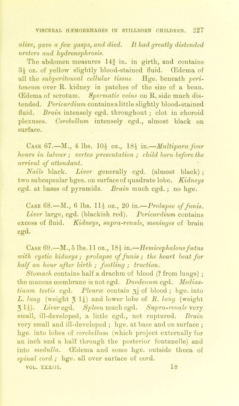 alive, gave a few gasps, and died. It had greatly distended ureters and hydronephrosis. The abdomen measures 14f in. in girth, and contains oz. of yellow slightly blood-stained fluid. (Edema of all the sxbbperitoneal cellular tissxie Hge. beneath peri- toneum over R. kidney in patches of the size of a bean. (Edema of scrotum. Spermatic veins on R. side much dis- tended. Pericardium contains a little slightly blood-stained fluid. Brain intensely cgd. throughout ; clot in choroid plexuses. Cerebellum intensely cgd., almost black on surface. Case 67.—M., 4 lbs. 10^ oz., 18^ in.—Multipara four hours in labour ; vertex presentation ; child born before the arrival of attendant. Nails black. Liver generally cgd. (almost black) ; two subcapsular hges. on surface of quadrate lobe. Kidneys cgd. at bases of pyramids. Brain much cgd.; no hge. Case 68.—M., 6 lbs. 11| oz., 20 in.—Prolapse of funis. Liver large, cgd. (blackish red). Pericardium contains excess of fluid. Kidneys, supra-renals, meninges of brain cgd. Case 69.—M., 5 lbs. 11 oz., 18£ in.—Hemicephalousfoetus with cystic kidneys ; prolapse of funis ; the heart beat for half an hour after birth ; footling ; traction. Stomach contains half a drachm of blood (? from lungs) ; the mucous membrane is not cgd. Duodenum cgd. Medias- tinum testis cgd. Pleurse contain 3j of blood ; hge. into L. lung (weight 3 1?) and lower lobe of R. lung (weight 3 H). Liver cgd. Spleen much cgd. Supra-renals very small, ill-developed, a little cgd., not ruptured. Brain very small and ill-developed ; hge. at base and on surface ; hge. into lobes of cerebellum (which project externally for an inch and a half through the posterior fontanelle) and into medulla. (Edema and some hge. outside theca of spinal cord ; hge. all over surface of cord. VOL. XXXIII. 18