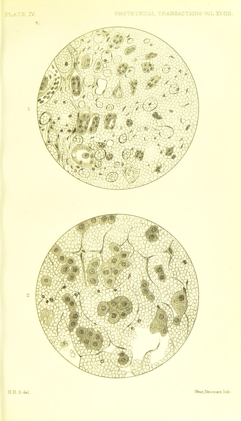 PLATE IV. OBSTETRICAL TRANSACTIONS V0L/XXX1I1. H R S del We at, Newman lith