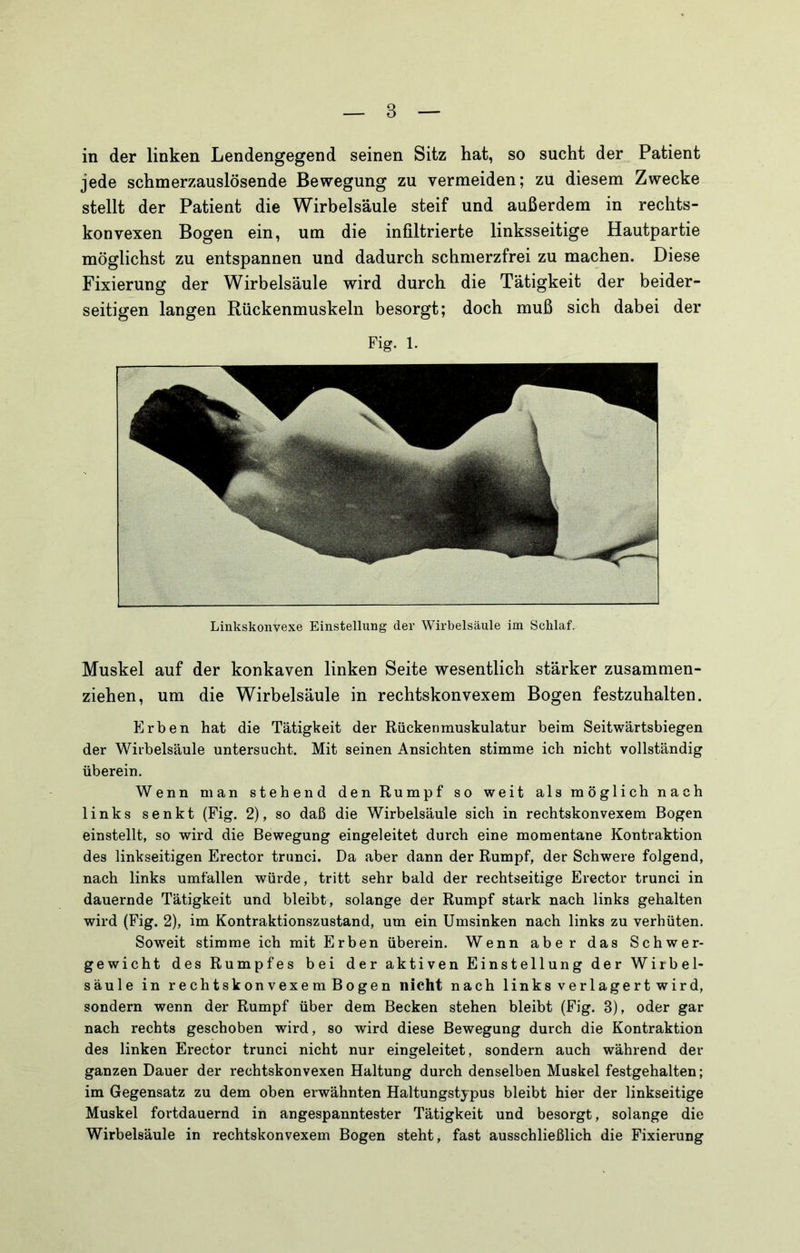 in der linken Lendengegend seinen Sitz hat, so sucht der Patient jede schmerzauslösende Bewegung zu vermeiden; zu diesem Zwecke stellt der Patient die Wirbelsäule steif und außerdem in rechts- konvexen Bogen ein, um die infiltrierte linksseitige Hautpartie möglichst zu entspannen und dadurch schmerzfrei zu machen. Diese Fixierung der Wirbelsäule wird durch die Tätigkeit der beider- seitigen langen Rückenmuskeln besorgt; doch muß sich dabei der Fig. 1. Linkskonvexe Einstellung der Wirbelsäule im Schlaf. Muskel auf der konkaven linken Seite wesentlich stärker zusammen- ziehen, um die Wirbelsäule in rechtskonvexem Bogen festzuhalten. Erben hat die Tätigkeit der Rückenmuskulatur beim Seitwärtsbiegen der Wirbelsäule untersucht. Mit seinen Ansichten stimme ich nicht vollständig überein. Wenn man stehend den Rumpf so weit als möglich nach links senkt (Fig. 2), so daß die Wirbelsäule sich in rechtskonvexem Bogen einstellt, so wird die Bewegung eingeleitet durch eine momentane Kontraktion des linkseitigen Erector trunci. Da aber dann der Rumpf, der Schwere folgend, nach links Umfallen würde, tritt sehr bald der rechtseitige Erector trunci in dauernde Tätigkeit und bleibt, solange der Rumpf stark nach links gehalten wird (Fig. 2), im Kontraktionszustand, um ein Umsinken nach links zu verhüten. Soweit stimme ich mit Erben überein. Wenn aber das Schwer- gewicht des Rumpfes bei der aktiven Einstellung der Wirbel- säule in rechtskon vexe m Bogen nicht nach links verlagert wird, sondern wenn der Rumpf über dem Becken stehen bleibt (Fig. 3), oder gar nach rechts geschoben wird, so wird diese Bewegung durch die Kontraktion des linken Erector trunci nicht nur eingeleitet, sondern auch während der ganzen Dauer der rechtskonvexen Haltung durch denselben Muskel festgehalten; im Gegensatz zu dem oben erwähnten Haltungstypus bleibt hier der linkseitige Muskel fortdauernd in angespanntester Tätigkeit und besorgt, solange die Wirbelsäule in rechtskonvexem Bogen steht, fast ausschließlich die Fixierung