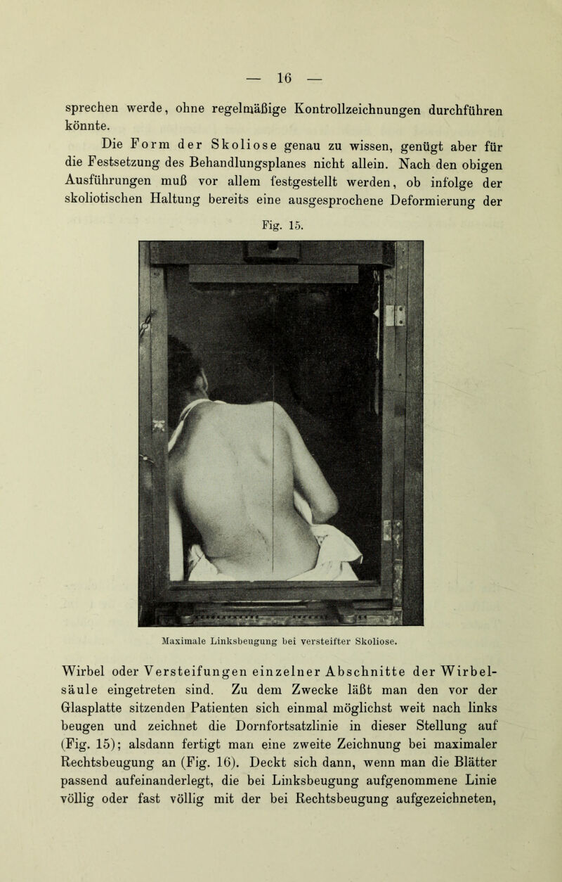 sprechen werde, ohne regelmäßige Kontrollzeichnungen durchführen könnte. Die Form der Skoliose genau zu wissen, genügt aber für die Festsetzung des Behandlungsplanes nicht allein. Nach den obigen Ausführungen muß vor allem festgestellt werden, ob infolge der skoliotischen Haltung bereits eine ausgesprochene Deformierung der Fig. 15. Maximale Linksbeugung bei vei’steifter Skoliose. Wirbel oder Versteifungen einzelner Abschnitte der Wirbel- säule eingetreten sind. Zu dem Zwecke läßt man den vor der Glasplatte sitzenden Patienten sich einmal möglichst weit nach links beugen und zeichnet die Dornfortsatzlinie in dieser Stellung auf (Fig. 15); alsdann fertigt man eine zweite Zeichnung bei maximaler Rechtsbeugung an (Fig. 16). Deckt sich dann, wenn man die Blätter passend aufeinanderlegt, die bei Linksbeugung aufgenommene Linie völlig oder fast völlig mit der bei Rechtsbeugung aufgezeichneten,