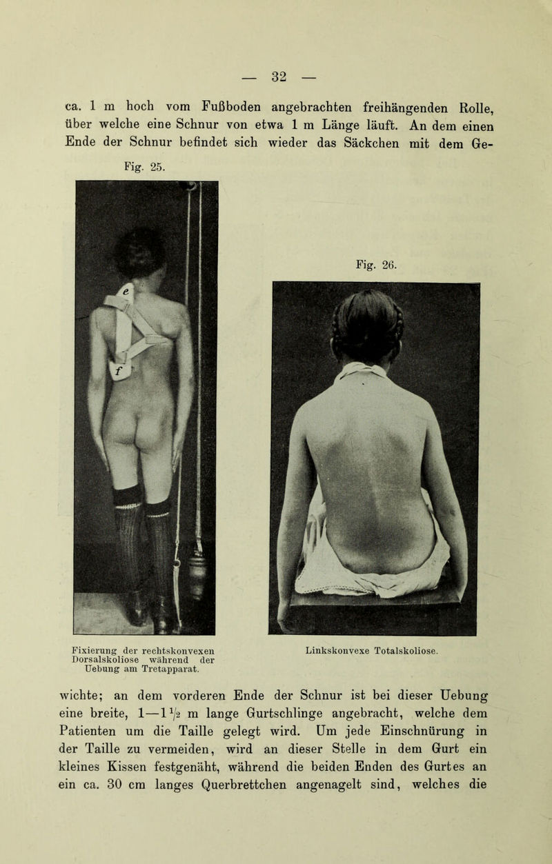 ca. 1 m hoch vom Fußboden angebrachten freihängenden Rolle, über welche eine Schnur von etwa 1 m Länge läuft. An dem einen Ende der Schnur befindet sich wieder das Säckchen mit dem Ge- Fig. 25. Fig. 26. Fixierung der rechtskonvexen Linkskonvexe Totalskoliose. Dorsalskoliose während der Hebung am Tretapparat. wichte; an dem vorderen Ende der Schnur ist bei dieser Uebung eine breite, 1—1^/2 m lange Gurtschlinge angebracht, welche dem Patienten um die Taille gelegt wird. Um jede Einschnürung in der Taille zu vermeiden, wird an dieser Stelle in dem Gurt ein kleines Kissen festgenäht, während die beiden Enden des Gurtes an ein ca. 30 cm langes Querbrettchen angenagelt sind, welches die