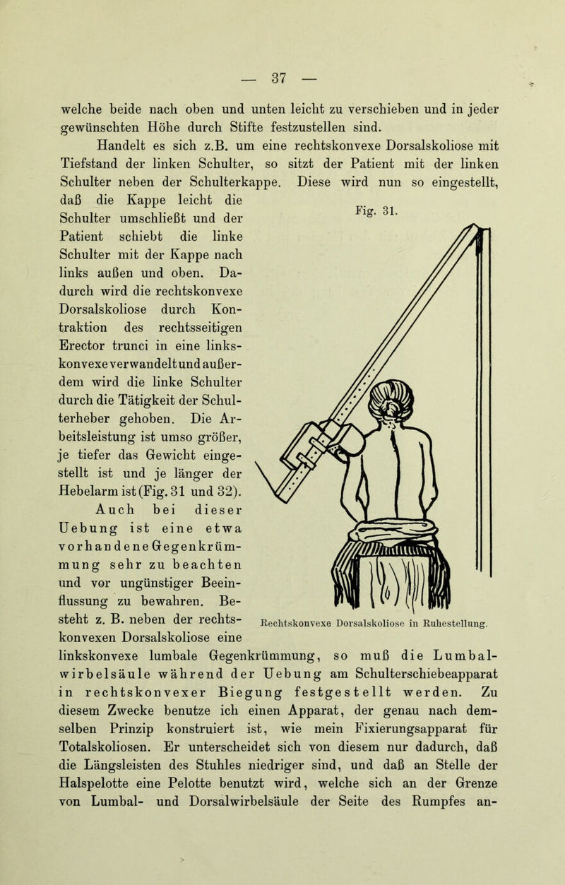 Fier. 31. welche beide nach oben und unten leicht zu verschieben und in jeder gewünschten Höhe durch Stifte festzustellen sind. Handelt es sich z.B. um eine rechtskonvexe Dorsalskoliose mit Tiefstand der linken Schulter, so sitzt der Patient mit der linken Schulter neben der Schulterkappe. Diese wird nun so eingestellt, daß die Kappe leicht die Schulter umschließt und der Patient schiebt die linke Schulter mit der Kappe nach links außen und oben. Da- durch wird die rechtskonvexe Dorsalskoliose durch Kon- traktion des rechtsseitigen Erector trunci in eine links- konvexe verwandelt und außer- dem wird die linke Schulter durch die Tätigkeit der Schul- terheber gehoben. Die Ar- beitsleistung ist umso größer, je tiefer das Gewicht einge- stellt ist und je länger der Hebelarm ist (Fig. 31 und 32). Auch bei dieser Hebung ist eine etwa vorhandene Gegen kr üm- mung sehr zu beachten und vor ungünstiger Beein- flussung zu bewahren. Be- steht z. B. neben der rechts- konvexen Dorsalskoliose eine linkskonvexe lumbale Gegenkrümmung, so muß die Lumbal- wirbelsäule während der Hebung am Schulterschiebeapparat in rechtskonvexer Biegung festgestellt werden. Zu diesem Zwecke benutze ich einen Apparat, der genau nach dem- selben Prinzip konstruiert ist, wie mein Fixierungsapparat für Totalskoliosen. Er unterscheidet sich von diesem nur dadurch, daß die Längsleisten des Stuhles niedriger sind, und daß an Stelle der Halspelotte eine Pelotte benutzt wird, welche sich an der Grenze von Lumbal- und Dorsalwirbelsäule der Seite des Rumpfes an-