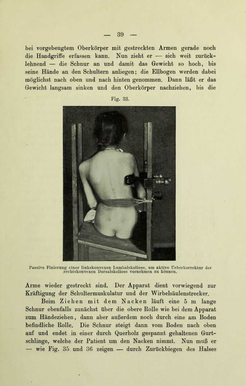 bei vorgebeugtem Oberkörper mit gestreckten Armen gerade noch die Handgriffe erfassen kann. Nun zieht er — sich weit zurück- lehnend — die Schnur an und damit das Gewicht so hoch, bis seine Hände an den Schultern anliegen; die Ellbogen werden dabei möglichst nach oben und nach hinten genommen. Dann läßt er das Gewicht langsam sinken und den Oberkörper nachziehen, bis die Fig. 33. Passive Fixierung einer linkskonvexen Lum’oalskoliose, um aktive Ueberkorrektur der rechtskonvexen Dorsalskoliose vornehmen zu können. Arme wieder gestreckt sind. Der Apparat dient vorwiegend zur Kräftigung der Schultermuskulatur und der Wirbelsäulenstrecker. Beim Ziehen mit dem Nacken läuft eine 5 m lange Schnur ebenfalls zunächst über die obere Rolle wie bei dem Apparat zum Händeziehen, dann aber außerdem noch durch eine am Boden befindliche Rolle. Die Schnur steigt dann vom Boden nach oben auf und endet in einer durch Querholz gespannt gehaltenen Gurt- schlinge, welche der Patient um den Nacken nimmt. Nun muß er — wie Fig. 35 und 36 zeigen — durch Zurückbiegen des Halses