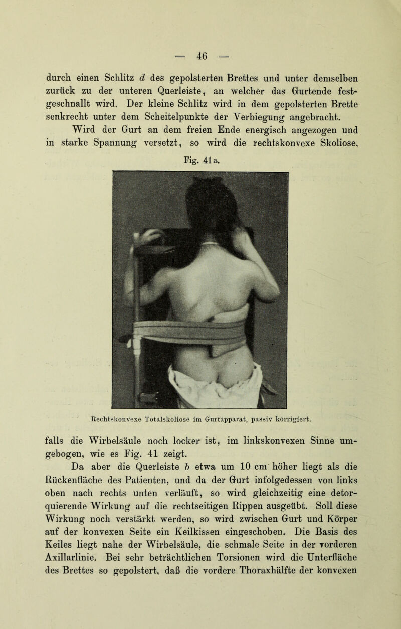 durch einen Schlitz d des gepolsterten Brettes und unter demselben zurück zu der unteren Querleiste, an welcher das Gurtende fest- geschnallt wird. Der kleine Schlitz wird in dem gepolsterten Brette senkrecht unter dem Scheitelpunkte der Verbiegung angebracht. Wird der Gurt an dem freien Ende energisch angezogen und in starke Spannung versetzt, so wird die rechtskonvexe Skoliose, Fig. 41a. Rechtskonvexe Totalskoliose im Gurtapparat, passiv korrigiert. falls die Wirbelsäule noch locker ist, im linkskonvexen Sinne um- gebogen, wie es Fig. 41 zeigt. Da aber die Querleiste h etwa um 10 cm höher liegt als die ßückenfläche des Patienten, und da der Gurt infolgedessen von links oben nach rechts unten verläuft, so wird gleichzeitig eine detor- quierende Wirkung auf die rechtseitigen Rippen ausgeübt. Soll diese Wirkung noch verstärkt werden, so wird zwischen Gurt und Körper auf der konvexen Seite ein Keilkissen eingeschoben. Die Basis des Keiles liegt nahe der Wirbelsäule, die schmale Seite in der vorderen Axillarlinie. Bei sehr beträchtlichen Torsionen wird die Unterfläche des Brettes so gepolstert, daß die vordere Thoraxhälfte der konvexen