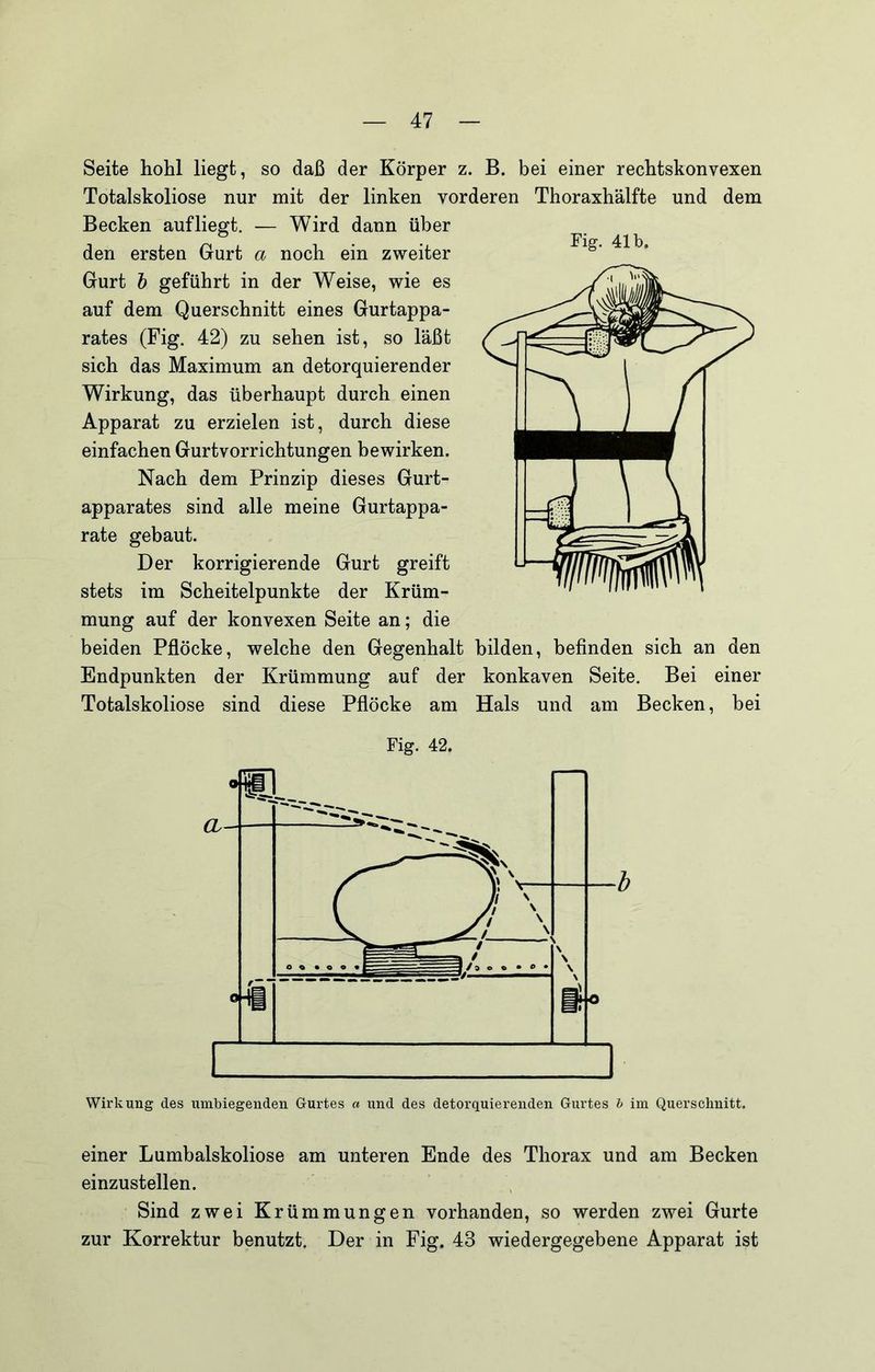 Seite hohl liegt, so daß der Körper z. B. bei einer rechtskonvexen Totalskoliose nur mit der linken vorderen Thoraxhälfte und dem Becken auf liegt. — Wird dann über den ersten Gurt a noch ein zweiter Gurt h geführt in der Weise, wie es auf dem Querschnitt eines Gurtappa- rates (Fig. 42) zu sehen ist, so läßt sich das Maximum an detorquierender Wirkung, das überhaupt durch einen Apparat zu erzielen ist, durch diese einfachen Gurtvorrichtungen bewirken. Nach dem Prinzip dieses Gurt- apparates sind alle meine Gurtappa- rate gebaut. Der korrigierende Gurt greift stets im Scheitelpunkte der Krüm- mung auf der konvexen Seite an; die beiden Pflöcke, welche den Gegenhalt bilden, befinden sich an den Endpunkten der Krümmung auf der konkaven Seite. Bei einer Totalskoliose sind diese Pflöcke am Hals und am Becken, bei Fig. 42. Wirkung des umbiegenden Gurtes « und des detorquierenden Gurtes h im Querschnitt. einer Lumbalskoliose am unteren Ende des Thorax und am Becken einzustellen. Sind zwei Krümmungen vorhanden, so werden zwei Gurte zur Korrektur benutzt. Der in Fig. 43 wiedergegebene Apparat ist