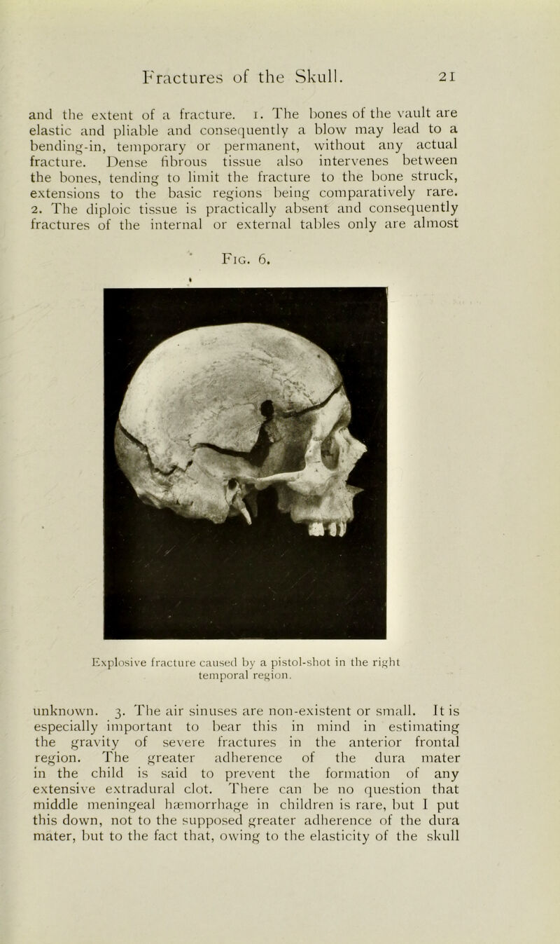 and the extent of a fracture, i. The bones of the vault are elastic and pliable and consequently a blow may lead to a bending-in, temporary or permanent, without any actual fracture. Dense fibrous tissue also intervenes between the bones, tending to limit the fracture to the bone struck, extensions to the basic regions being comparatively rare. 2. The diploic tissue is practically absent and consequently fractures of the internal or external tables only are almost Fig. 6. Explosive fracture caused by a pistol-shot in the right temporal region. unknown. 3. The air sinuses are non-existent or small. It is especially important to bear this in mind in estimating the gravity of severe fractures in the anterior frontal region. The greater adherence of the dura mater in the child is said to prevent the formation of any extensive extradural clot. There can be no question that middle meningeal haemorrhage in children is rare, but I put this down, not to the supposed greater adherence of the dura mater, but to the fact that, owing to the elasticity of the skull