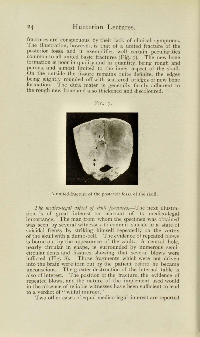 fractures are conspicuous by their lack of clinical symptoms, the illustration, however, is that of a united fracture of the posterior fossa and it exemplifies well certain peculiarities common to all united basic fractures (Fig. 7). The new bone formation is poor in quality and in quantity, being rough and porous, and almost limited to the inner aspect of the skull. On the outside the fissure remains quite definite, the edges being slightly rounded off with scattered bridges of new bone formation. The dura mater is generally firmly adherent to the rough new bone and also thickened and discoloured. Fig. 7. A united fracture of the posterior fossa of the skull. The medico-legal aspect of skull fractures.—The next illustra- tion is of great interest on account of its medico-legal importance. The man from whom the specimen was obtained was seen by several witnesses to commit suicide in a state of suicidal frenzy by striking himself repeatedly on the vertex of the skull with a dumb-bell. The evidence of repeated blows is borne out by the appearance of the vault. A central hole, nearly circular in shape, is surrounded by numerous semi- circular dents and fissures, showing that several blows were indicted (Fig. 8). Those fragments which were not driven into the brain were torn out by the patient before he became unconscious. The greater destruction of the internal table is also of interest. The position of the fracture, the evidence of repeated blows, and the nature of the implement used would in the absence of reliable witnesses have been sufficient to lead to a verdict of “ wilful murder. Two other cases of equal medico-legal interest are reported