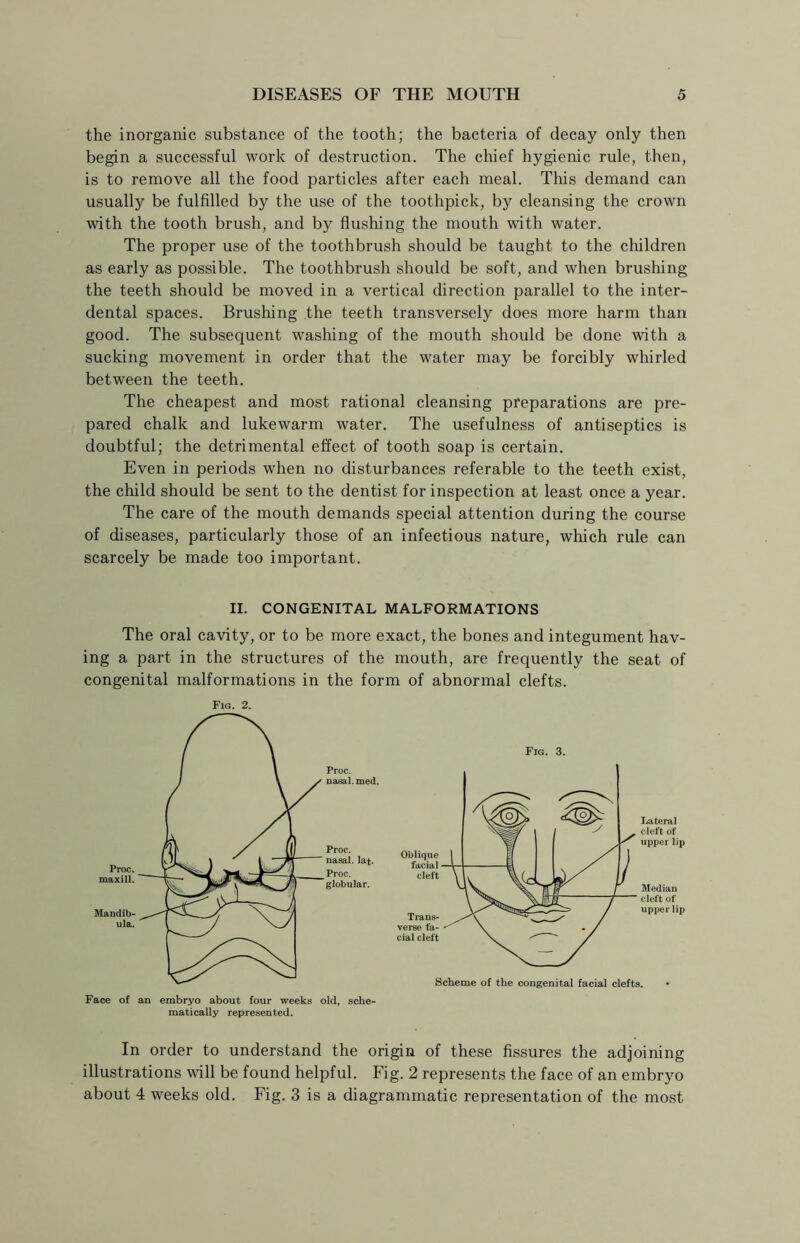 the inorganic substance of the tooth; the bacteria of decay only then begin a successful work of destruction. The chief hygienic rule, then, is to remove all the food particles after each meal. This demand can usually be fulfilled by the use of the toothpick, by cleansing the crown with the tooth brush, and by flushing the mouth with water. The proper use of the toothbrush should be taught to the children as early as possible. The toothbrush should be soft, and when brushing the teeth should be moved in a vertical direction parallel to the inter- dental spaces. Brushing the teeth transversely does more harm than good. The subsequent washing of the mouth should be done with a sucking movement in order that the water may be forcibly whirled between the teeth. The cheapest and most rational cleansing preparations are pre- pared chalk and lukewarm water. The usefulness of antiseptics is doubtful; the detrimental effect of tooth soap is certain. Even in periods when no disturbances referable to the teeth exist, the child should be sent to the dentist for inspection at least once a year. The care of the mouth demands special attention during the course of diseases, particularly those of an infectious nature, which rule can scarcely be made too important. II. CONGENITAL MALFORMATIONS The oral cavity, or to be more exact, the bones and integument hav- ing a part in the structures of the mouth, are frequently the seat of congenital malformations in the form of abnormal clefts. Fig. 2. Lateral cleft of upper lip Median cleft of upper lip Face of an embryo about four weeks old, sche- matically represented. In order to understand the origin of these fissures the adjoining illustrations will be found helpful. Fig. 2 represents the face of an embryo about 4 weeks old. Fig. 3 is a diagrammatic representation of the most