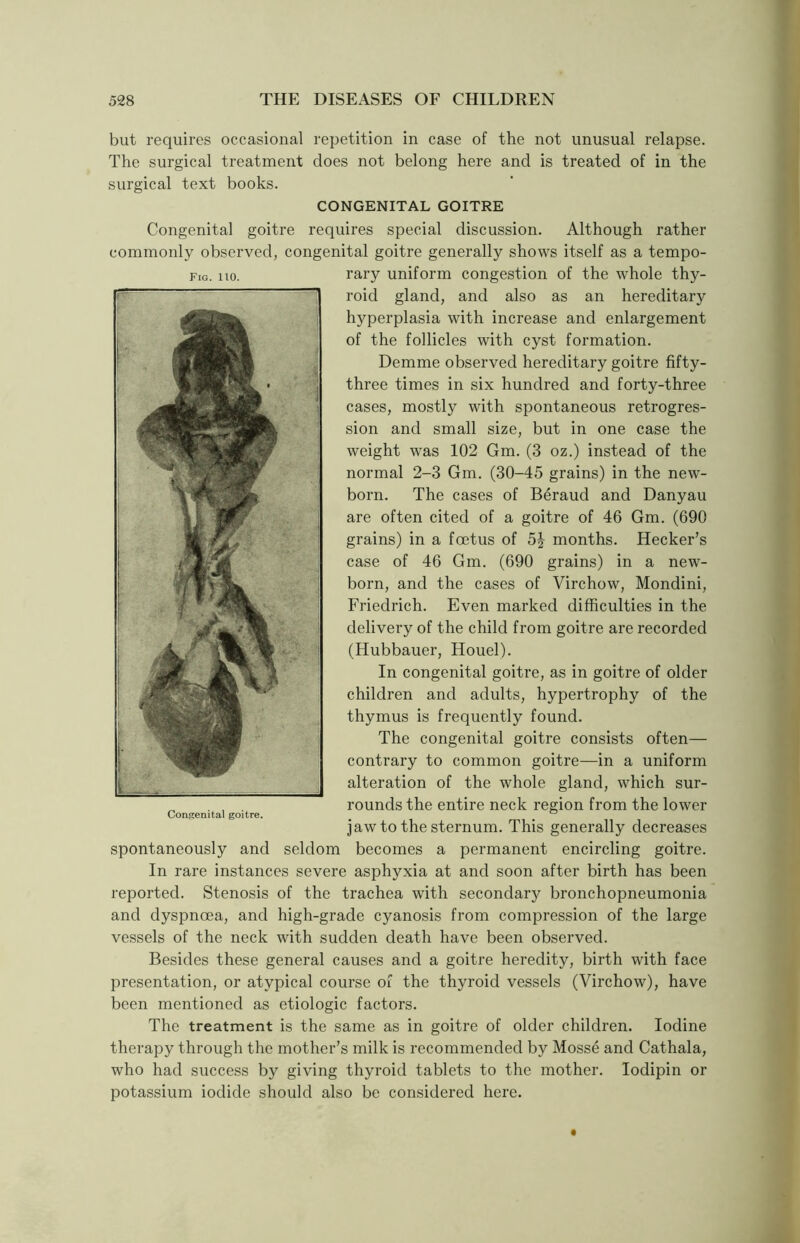 but requires occasional repetition in case of the not unusual relapse. The surgical treatment does not belong here and is treated of in the surgical text books. CONGENITAL GOITRE Congenital goitre requires special discussion. Although rather commonly observed, congenital goitre generally shows itself as a tempo- rary uniform congestion of the whole thy- roid gland, and also as an hereditary hyperplasia with increase and enlargement of the follicles with cyst formation. Demme observed hereditary goitre fifty- three times in six hundred and forty-three cases, mostly with spontaneous retrogres- sion and small size, but in one case the weight was 102 Gm. (3 oz.) instead of the normal 2-3 Gm. (30-45 grains) in the new- born. The cases of Beraud and Danyau are often cited of a goitre of 46 Gm. (690 grains) in a foetus of 5J months. Hecker’s case of 46 Gm. (690 grains) in a new- born, and the cases of Virchow, Mondini, Friedrich. Even marked difficulties in the delivery of the child from goitre are recorded (Hubbauer, Houel). In congenital goitre, as in goitre of older children and adults, hypertrophy of the thymus is frequently found. The congenital goitre consists often— contrary to common goitre—in a uniform alteration of the whole gland, which sur- rounds the entire neck region from the lower jaw to the sternum. This generally decreases spontaneously and seldom becomes a permanent encircling goitre. In rare instances severe asphyxia at and soon after birth has been reported. Stenosis of the trachea with secondary bronchopneumonia and dyspncea, and high-grade cyanosis from compression of the large vessels of the neck with sudden death have been observed. Besides these general causes and a goitre heredity, birth with face presentation, or atypical course of the thyroid vessels (Virchow), have been mentioned as etiologic factors. The treatment is the same as in goitre of older children. Iodine therapy through the mother’s milk is recommended by Mosse and Cathala, who had success by giving thyroid tablets to the mother. Iodipin or potassium iodide should also be considered here. Fig. 110. Congenital goitre.