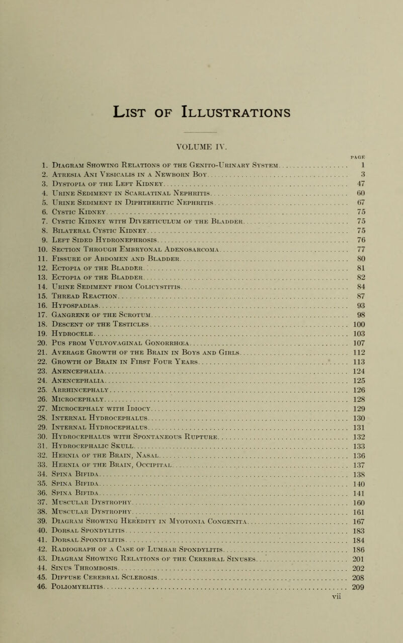 List of Illustrations VOLUME IV. PAGE 1. Diagram Showing Relations of the Genito-Uuinary System 1 2. Atresia Ani Vesicalis in a Newborn Boy 3 3. Dystopia of the Left Kidney 47 4. Ltrine Sediment in Scarlatinal Nephritis (»0 5. Urine Sediment in Diphtheritic Nephritis (V7 6. Cystic Kidney 75 7. Cystic Kidney with Diverticulum of the Bladder 75 8. Bilateral Cystic Kidney 75 9. Left Sided Hydronephrosis 76 10. Section Through Embryonal Adenosarcoma 77 11. Fissure of Abdomen and Bladder 80 12. Ectopia of the Bladder 81 13. Ectopia of the Bladder 82 14. LTrine Sediment from Colicystitis 84 15. Thread Reaction 87 16. Hypospadias 93 17. Gangrene of the Scrotum 98 18. Descent of the Testicles 100 19. Hydrocele 103 20. Pus from Vulvovaginal Gonorrhcea 107 21. Average Growth of the Brain in Boys and Girls 112 22. Growth of Brain in First Four Years 113 23. Anencephalia 124 24. Anencephalia 125 25. Arrhincephaly 126 26. Microcephaly 128 27. Microcephaly with Idiocy 129 28. Internal Hydrocephalus 130 29. Internal Hydrocephalus 131 30. Hydrocephalus with Spontaneous Rupture 132 31. Hydrocephalic Skull 133 32. Hernia of the Brain, Nasal 136 33. Hernia of the Brain, Occipital 137 34. Spina Bifida 138 35. Spina Bifida 140 36. Spina Bifida 141 37. Muscular Dystrophy 160 38. Muscular Dystrophy 161 39. Diagram Showing Heredity in Myotonia Congenita 167 40. Dorsal Spondylitis 183 41. Dorsal Spondylitis 184 42. Radiograph of a Case of Lumbar Spondylitis 186 43. Diagram Showing Relations of the Cerebral Sinuses. 201 44. Sinus Thrombosis 202 45. Diffuse Cerebral Sclerosis 208 46. Poliomyelitis 209