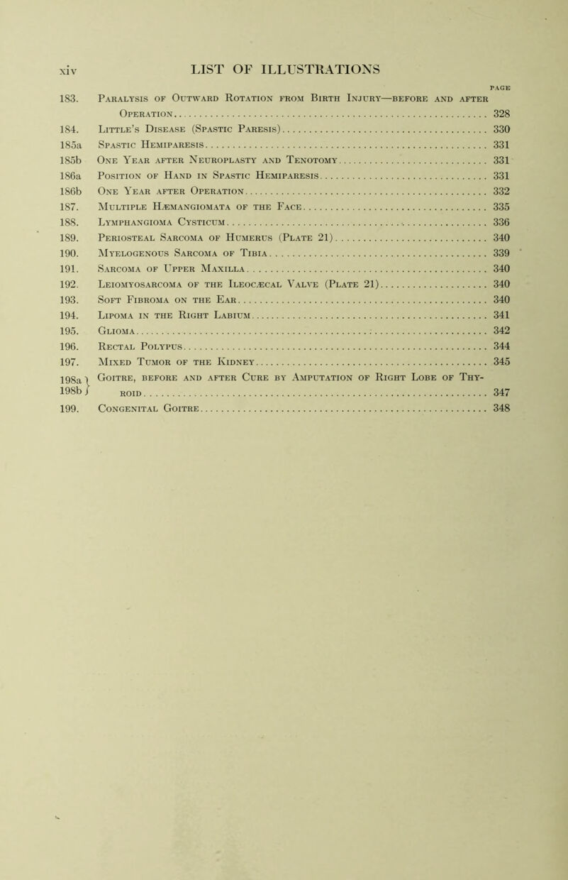 page; 183. Paralysis of Outward Rotation from Birth Injury—before and after Operation 328 184. Little’s Disease (Spastic Paresis) 330 185a Spastic Hemiparesis 331 185b One Year after Neuroplasty and Tenotomy 331 186a Position of Hand in Spastic Hemiparesis 331 186b One Year after Operation 332 187. Multiple Haemangiomata of the Face 335 188. Lymphangioma Cysticum 336 189. Periosteal Sarcoma of Humerus (Plate 21) 340 190. Myelogenous Sarcoma of Tibia 339 191. Sarcoma of Upper Maxilla 340 192. Leiomyosarcoma of the Ileocecal Valve (Plate 21) 340 193. Soft Fibroma on the Ear 340 194. Lipoma in the Right Labium 341 195. Glioma 342 196. Rectal Polypus 344 197. Mixed Tumor of the Kidney 345 198a 1 Goitre, before and after Cure by Amputation of Right Lobe of Thy- 198b J roid 347 199. Congenital Goitre 348