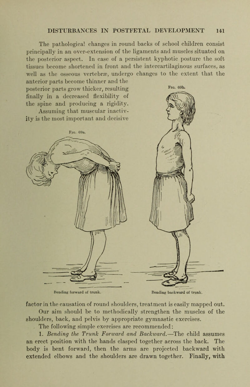 The pathological changes in round backs of school children consist principally in an over-extension of the ligaments and muscles situated on the posterior aspect. In case of a persistent kyphotic posture the soft tissues become shortened in front and the intercartilaginous surfaces, as well as the osseous vertebrae, undergo anterior parts become thinner and the posterior parts grow thicker, resulting finally in a decreased flexibility of the spine and producing a rigidity. Assuming that muscular inactiv- ity is the most important and decisive Fig. 69a. changes to the extent that the Fig. 69b. factor in the causation of round shoulders, treatment is easily mapped out. Our aim should be to methodically strengthen the muscles of the shoulders, back, and pelvis by appropriate gymnastic exercises. The following simple exercises are recommended: 1. Bending the Trunk Forward and Backward.—The child assumes an erect position with the hands clasped together across the back. The body is bent forward, then the arms are projected backward with extended elbows and the shoulders are drawn together. Finally, with