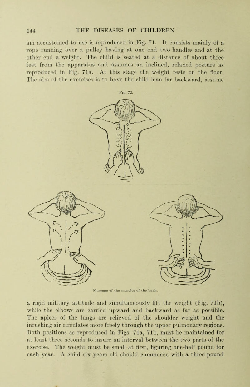 am accustomed to use is reproduced in Fig. 71. It consists mainly of a rope running over a pulley having at one end two handles and at the other end a weight. The child is seated at a distance of about three feet from the apparatus and assumes an inclined, relaxed posture as reproduced in Fig. 71a. At this stage the weight rests on the floor. The aim of the exercises is to have the child lean far backward, assume Fig. 72. Massage of the muscles of the back. a rigid military attitude and simultaneously lift the weight (Fig. 71b), while the elbows are carried upward and backward as far as possible. The apices of the lungs are relieved of the shoulder weight and the inrushing air circulates more freely through the upper pulmonary regions. Both positions as reproduced in Figs. 71a, 71b, must be maintained for at least three seconds to insure an interval between the two parts of the exercise. The weight must be small at first, figuring one-half pound for each year. A child six years old should commence with a three-pound