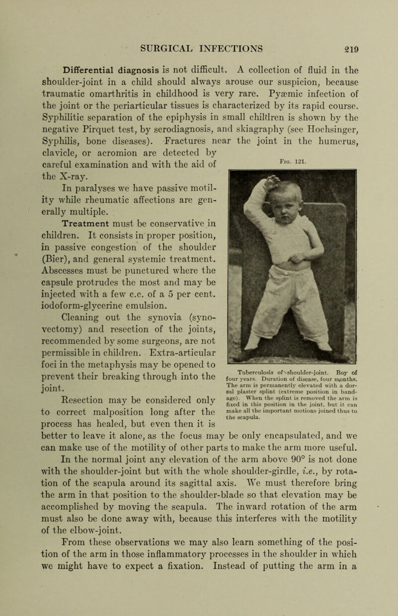 Differential diagnosis is not difficult. A collection of fluid in the shoulder-joint in a child should always arouse our suspicion, because traumatic omarthritis in childhood is very rare. Pyaemic infection of the joint or the periarticular tissues is characterized by its rapid course. Syphilitic separation of the epiphysis in small children is shown by the negative Pirquet test, by serodiagnosis, and skiagraphy (see Hochsinger, Syphilis, bone diseases). Fractures near the joint in the humerus, clavicle, or acromion are detected by careful examination and with the aid of the X-ray. In paralyses we have passive motil- ity while rheumatic affections are gen- erally multiple. Treatment must be conservative in children. It consists in proper position, in passive congestion of the shoulder (Bier), and general systemic treatment. Abscesses must be punctured where the capsule protrudes the most and may be injected with a few c.c. of a 5 per cent, iodoform-glycerine emulsion. Cleaning out the synovia (syno- vectomy) and resection of the joints, recommended by some surgeons, are not permissible in children. Extra-articular foci in the metaphysis may be opened to prevent their breaking through into the joint. Resection may be considered only to correct malposition long after the process has healed, but even then it is better to leave it alone, as the focus may be only encapsulated, and we can make use of the motility of other parts to make the arm more useful. In the normal joint any elevation of the arm above 90° is not done with the shoulder-joint but with the whole shoulder-girdle, i.e., by rota- tion of the scapula around its sagittal axis. We must therefore bring the arm in that position to the shoulder-blade so that elevation may be accomplished by moving the scapula. The inward rotation of the arm must also be done away with, because this interferes with the motility of the elbow-joint. From these observations we may also learn something of the posi- tion of the arm in those inflammatory processes in the shoulder in which we might have to expect a fixation. Instead of putting the arm in a Fig. 121. Tuberculosis of^shoulder-joint. Boy of four years. Duration of disease, four months. The arm is permanently elevated with a dor- sal plaster splint (extreme position in band- age). When the splint is removed the arm is fixed in this position in the joint, but it can make all the important motions joined thus to the scapula.