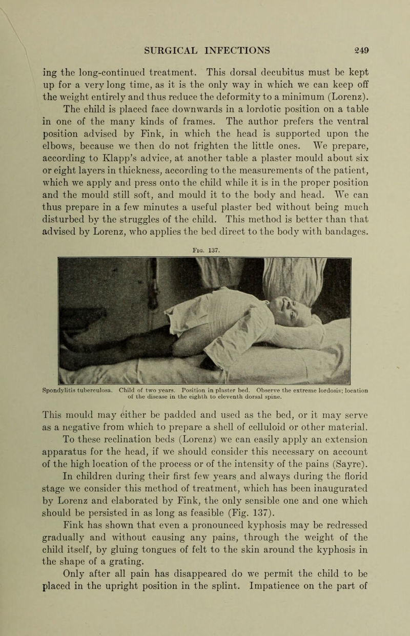 ing the long-continued treatment. This dorsal decubitus must be kept up for a very long time, as it is the only way in which we can keep off the weight entirely and thus reduce the deformity to a minimum (Lorenz). The child is placed face downwards in a lordotic position on a table in one of the many kinds of frames. The author prefers the ventral position advised by Fink, in which the head is supported upon the elbows, because we then do not frighten the little ones. We prepare, according to Klapp’s advice, at another table a plaster mould about six or eight layers in thickness, according to the measurements of the patient , which we apply and press onto the child while it is in the proper position and the mould still soft, and mould it to the body and head. We can thus prepare in a few minutes a useful plaster bed without being much disturbed by the struggles of the child. This method is better than that advised by Lorenz, who applies the bed direct to the body with bandages. Fig. 137. Spondylitis tuberculosa. Child of two years. Position in plaster bed. Observe the extreme lordosis; location of the disease in the eighth to eleventh dorsal spine. This mould may either be padded and used as the bed, or it may serve as a negative from which to prepare a shell of celluloid or other material. To these reclination beds (Lorenz) we can easily apply an extension apparatus for the head, if we should consider this necessary on account of the high location of the process or of the intensity of the pains (Sayre). In children during their first few years and always during the florid stage we consider this method of treatment, which has been inaugurated by Lorenz and elaborated by Fink, the only sensible one and one which should be persisted in as long as feasible (Fig. 137). Fink has shown that even a pronounced kyphosis may be redressed gradually and without causing any pains, through the weight of the child itself, by gluing tongues of felt to the skin around the kyphosis in the shape of a grating. Only after all pain has disappeared do we permit the child to be placed in the upright position in the splint. Impatience on the part of