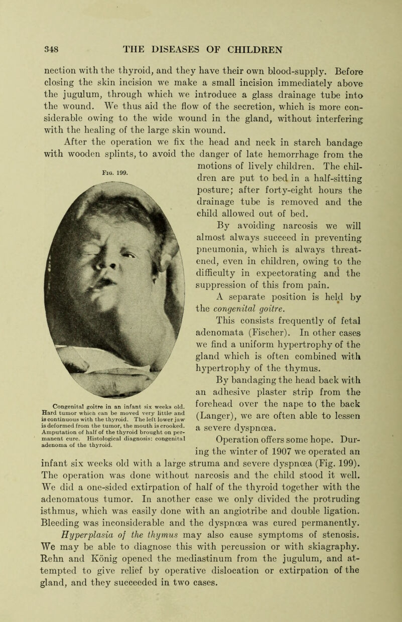 nection with the thyroid, and they have their own blood-supply. Before closing the skin incision we make a small incision immediately above the jugulum, through which we introduce a glass drainage tube into the wound. We thus aid the flow of the secretion, which is more con- siderable owing to the wide wound in the gland, without interfering with the healing of the large skin wound. After the operation we fix the head and neck in starch bandage with wooden splints, to avoid the danger of late hemorrhage from the motions of lively children. The chil- dren are put to bed in a half-sitting posture; after forty-eight hours the drainage tube is removed and the child allowed out of bed. By avoiding narcosis we will almost always succeed in preventing pneumonia, which is always threat- ened, even in children, owing to the difficulty in expectorating and the suppression of this from pain. A separate position is held by the congenital goitre. This consists frequently of fetal adenomata (Fischer). In other cases we find a uniform hypertrophy of the gland which is often combined with hypertrophy of the thymus. By bandaging the head back with an adhesive plaster strip from the forehead over the nape to the back (Langer), we are often able to lessen a severe dyspnoea. Operation offers some hope. Dur- ing the winter of 1907 we operated an infant six weeks old with a large struma and severe dyspnoea (Fig. 199). The operation was done without narcosis and the child stood it well. We did a one-sided extirpation of half of the thyroid together with the adenomatous tumor. In another case we only divided the protruding isthmus, which was easily done with an angiotribe and double ligation. Bleeding was inconsiderable and the dyspnoea was cured permanently. Hyperplasia of the thymus may also cause symptoms of stenosis. We may be able to diagnose this with percussion or with skiagraphy. Rehn and Konig opened the mediastinum from the jugulum, and at- tempted to give relief by operative dislocation or extirpation of the gland, and they succeeded in two cases. Fig. 199. Congenital goitre in an infant six weeks old. Hard tumor which can be moved very little and is continuous with the thyroid. The left lower jaw is deformed from the tumor, the mouth is crooked. Amputation of half of the thyroid brought on per- manent cure. Histological diagnosis: congenital adenoma of the thyroid.