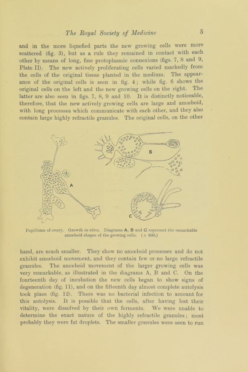 and in the more liquefied parts the new growing cells were more scattered (fig. 3), but as a rule they remained in contact with each other by means of long, fine protoplasmic connexions (figs. 7, 8 and 9, Plate II). The new actively proliferating cells varied markedly from the cells of the original tissue planted in the medium. The appear- ance of the original cells is seen in fig. 4 ; while fig. 6 shows the original cells on the left and the new growing cells on the right. The latter are also seen in figs. 7, 8, 9 and 10. It is distinctly noticeable, therefore, that the new actively growing cells are large and amoeboid, with long processes which communicate with each other, and they also contain large highly retractile granules. The original cells, on the other Papilloma of ovary. Growth in vitro. Diagrams A, B and C represent the remarkable amoeboid shapes of the growing cells. ( x 600.) hand, are much smaller. They show no amoeboid processes and do not exhibit amoeboid movement, and they contain few or no large retractile granules. The amoeboid movement of the larger growing cells was very remarkable, as illustrated in the diagrams A, B and C. On the fourteenth day of incubation the new cells began to show signs of degeneration (fig. II), and on the fifteenth day almost complete autolysis took place (fig. 12). There was no bacterial infection to account for this autolysis. It is possible that the cells, after having lost their vitality, were dissolved by their own ferments. We were unable to determine the exact nature of the highly retractile granules; most probably they were fat droplets. The smaller granules were seen to run