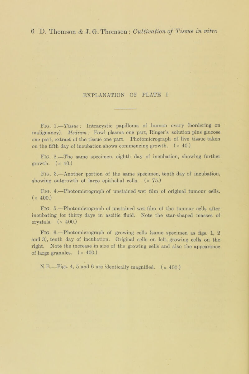 EXPLANATION OF PLATE J. Fig. 1.—Tissue : Intracystic papilloma of human ovary (bordering on malignancy). Medium : Fowl plasma one part, Einger’s solution plus glucose one part, extract of the tissue one part. Photomicrograph of live tissue taken on the fifth day of incubation shows commencing growth. (x 40.) Fig. 2.—The same specimen, eighth day of incubation, showing further growth. (X 40.) Fig. 3.—Another portion of the same specimen, tenth day of incubation, showing outgrowth of large epithelial cells, (x 75.) Fig. 4.—Photomicrograph of unstained wet film of original tumour cells, (x 400.) Fig. 5.—Photomicrograph of unstained wet film of the tumour cells after incubating for thirty days in ascitic fluid. Note the star-shaped masses of crystals, (x 400.) Fig. 6.—Photomicrograph of growing cells (same specimen as figs. 1, 2 and 3), tenth day of incubation. Original cells on left, growing cells on the right. Note the increase in size of the growing cells and also the appearance of large granules. (x 400.) N.B.—Figs. 4, 5 and 6 are identically magnified, (x 400.)