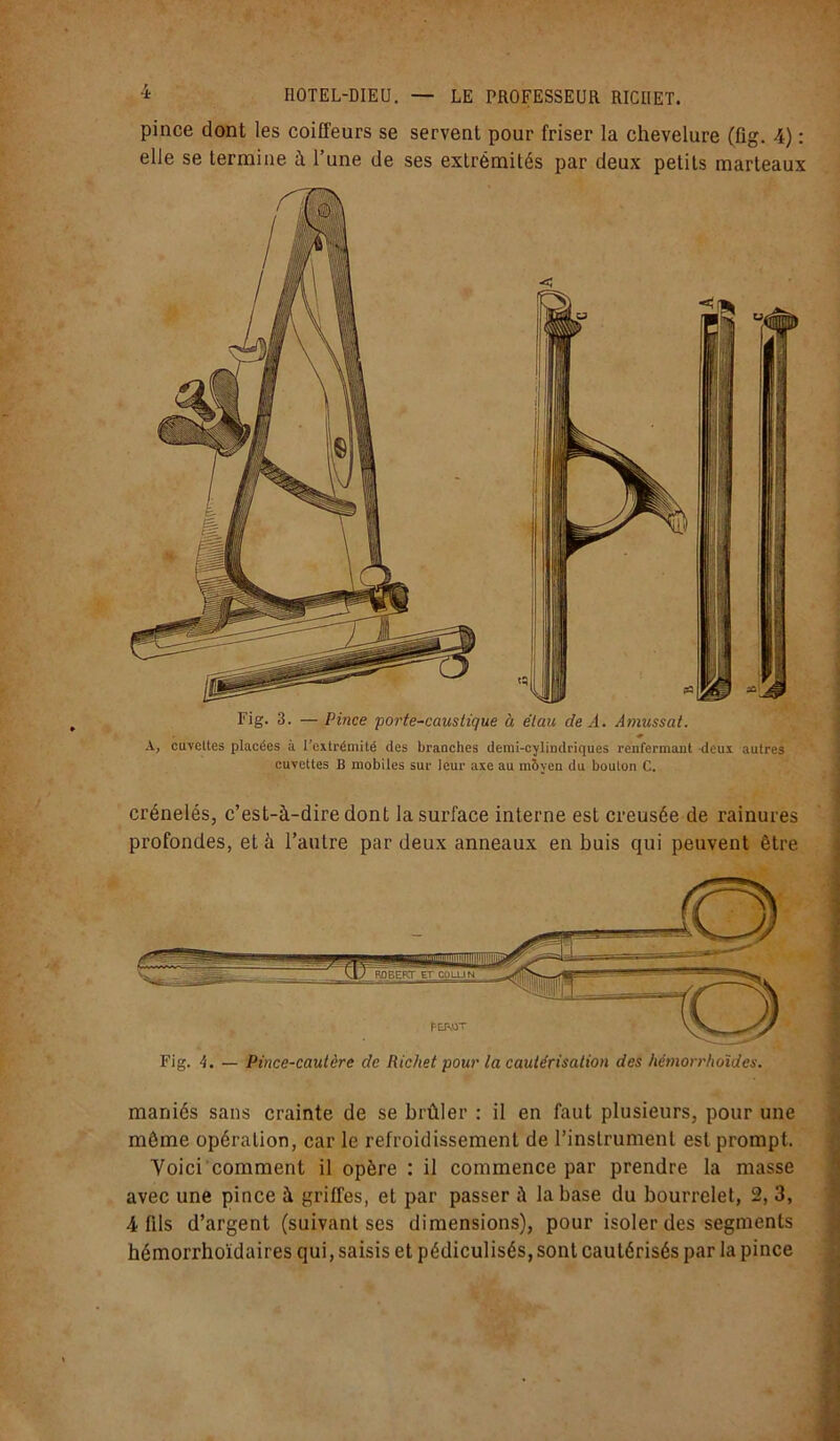 pince dont les coiffeurs se servent pour friser la chevelure (flg. 4) : elle se termine à l’une de ses extrémités par deux petits marteaux Fig. 3. —Pince 'porte-caustique à étau de A. Amussat. A, cuvettes placées à l’extrémité des braaches demi-cylindriques renfermant deux autres cuvettes B mobiles sur leur axe au moyen du bouton C. crénelés, c’est-à-dire dont la surface interne est creusée de rainures profondes, et à l’autre par deux anneaux en buis qui peuvent être Fig. 4. — Pince-cautère de Richet pour la cautérisation des hémorrhoïdes. maniés sans crainte de se brûler : il en faut plusieurs, pour une même opération, car le refroidissement de l’instrument est prompt. Voici comment il opère : il commence par prendre la masse avec une pince à griffes, et par passer à la base du bourrelet, 2, 3, 4 fils d’argent (suivant ses dimensions), pour isoler des segments hémorrhoïdaires qui, saisis et pédiculisés, sont cautérisés par la pince