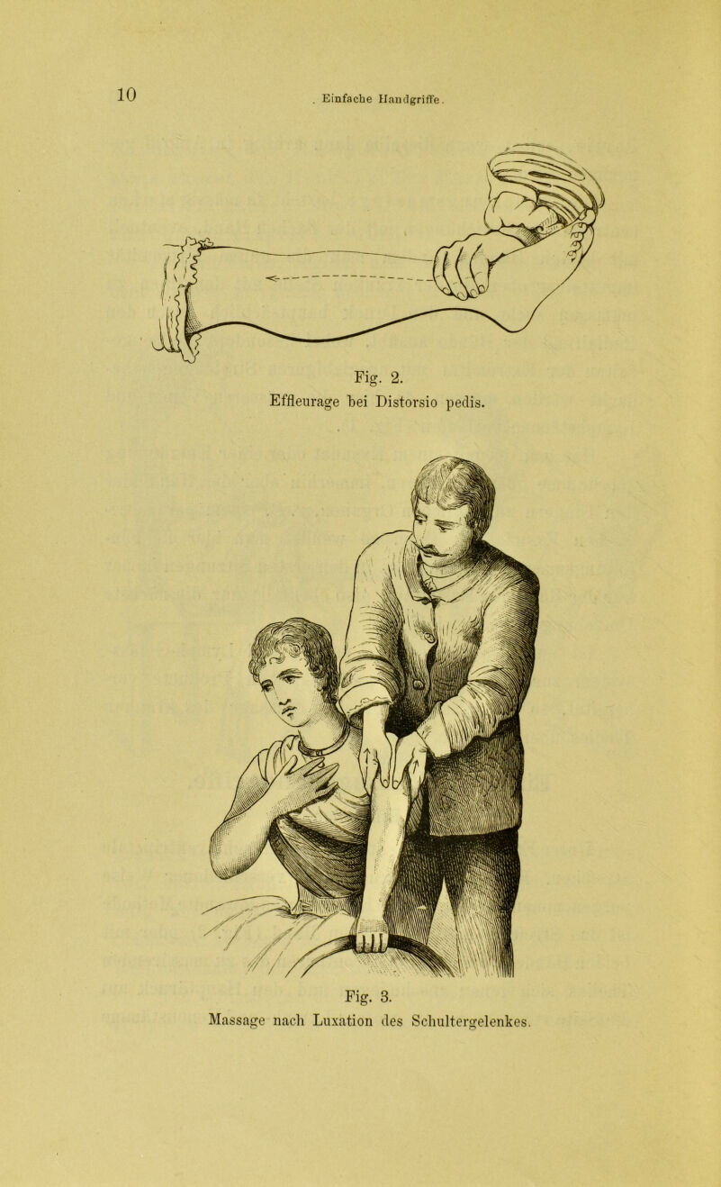 Fig. 2. Effleurage bei Distorsio pedis. Fig. 3. Massage nach Luxation des Schultergelenkes.