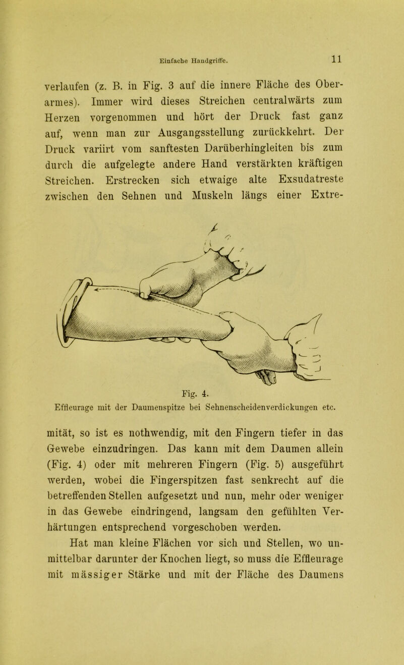 verlaufen (z. B. in Fig. 3 auf die innere Fläche des Ober- armes). Immer wird dieses Streichen centralwärts zum Herzen vorgenommen und hört der Druck fast ganz auf, wenn man zur Ausgangsstellung zurückkehrt. Der Druck variirt vom sanftesten Darüberhingleiten bis zum durch die aufgelegte andere Hand verstärkten kräftigen Streichen. Erstrecken sich etwaige alte Exsudatreste zwischen den Sehnen und Muskeln längs einer Extre- Effleurage mit der Daumenspitze bei Sehnenscheidenverdickungen etc. mität, so ist es nothwendig, mit den Fingern tiefer in das Gewebe einzudringen. Das kann mit dem Daumen allein (Fig. 4) oder mit mehreren Fingern (Fig. 5) ausgeführt werden, wobei die Fingerspitzen fast senkrecht auf die betreffenden Stellen aufgesetzt und nun, mehr oder weniger in das Gewebe eindringend, langsam den gefühlten Ver- härtungen entsprechend vorgeschoben werden. Hat man kleine Flächen vor sich und Stellen, wo un- mittelbar darunter der Knochen liegt, so muss die Effleurage mit mässiger Stärke und mit der Fläche des Daumens Z Fig. 4